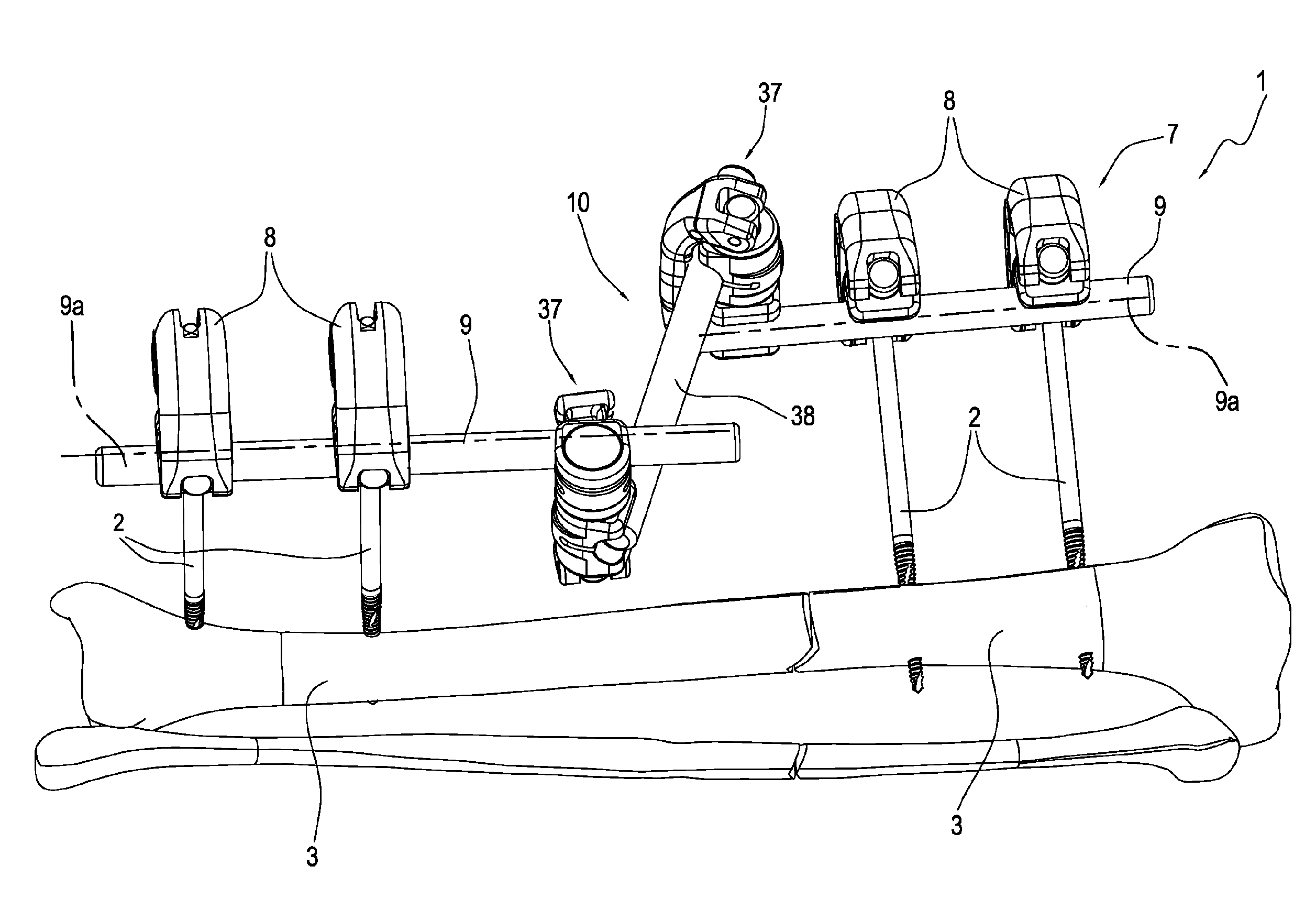 Multi-purpose external fixator