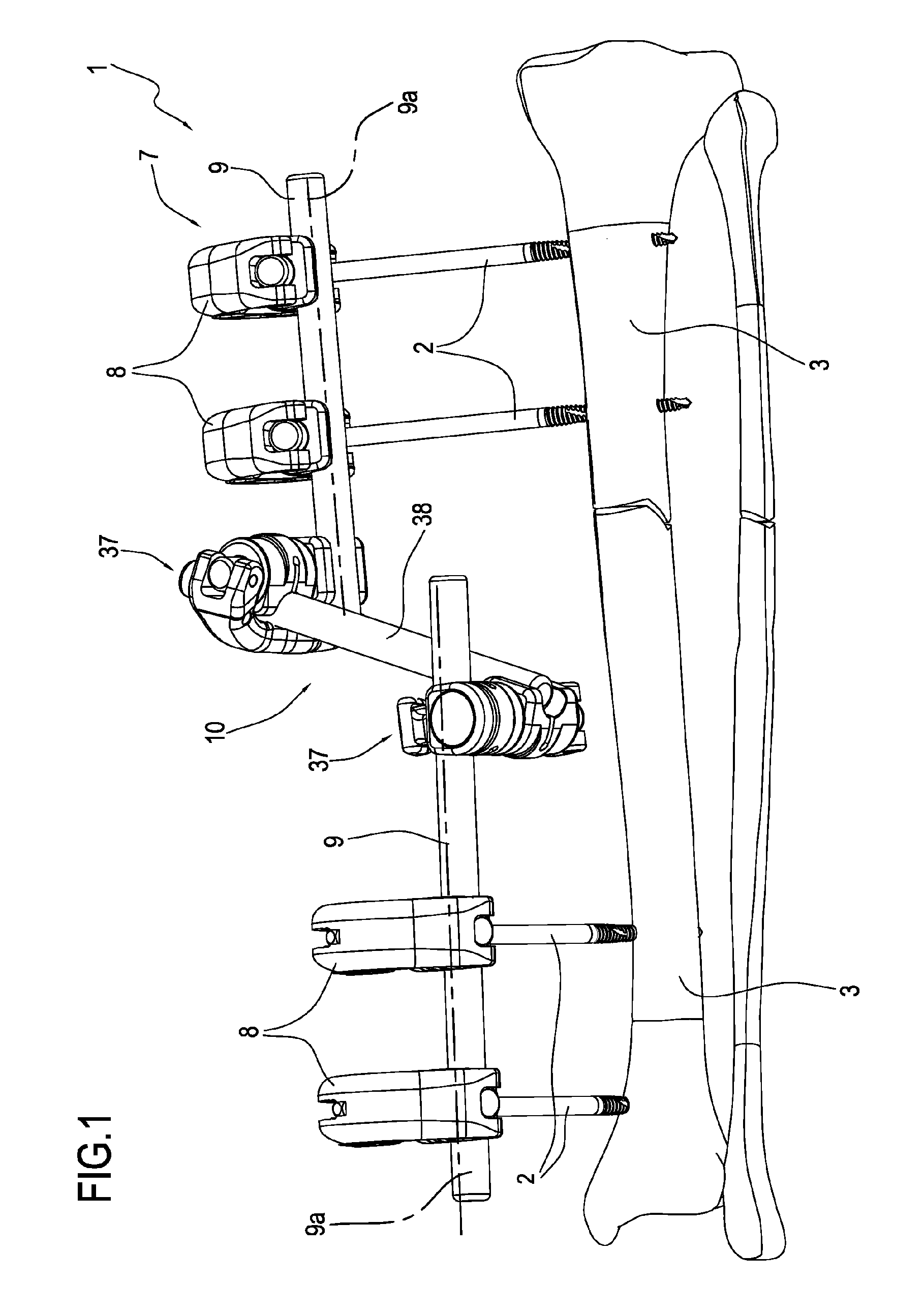 Multi-purpose external fixator