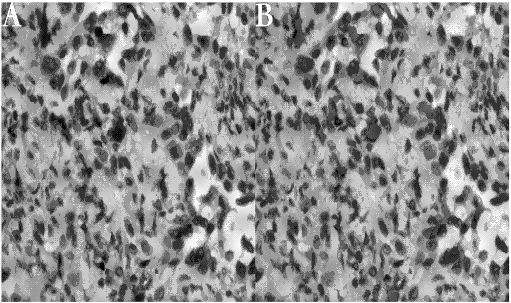 Establishing method of preoperative prediction model for lung cancer cell KI-67 expression index