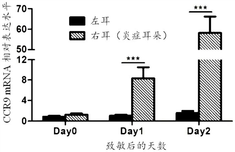 Mesenchymal stem cell for treating inflammatory bowel disease and application thereof