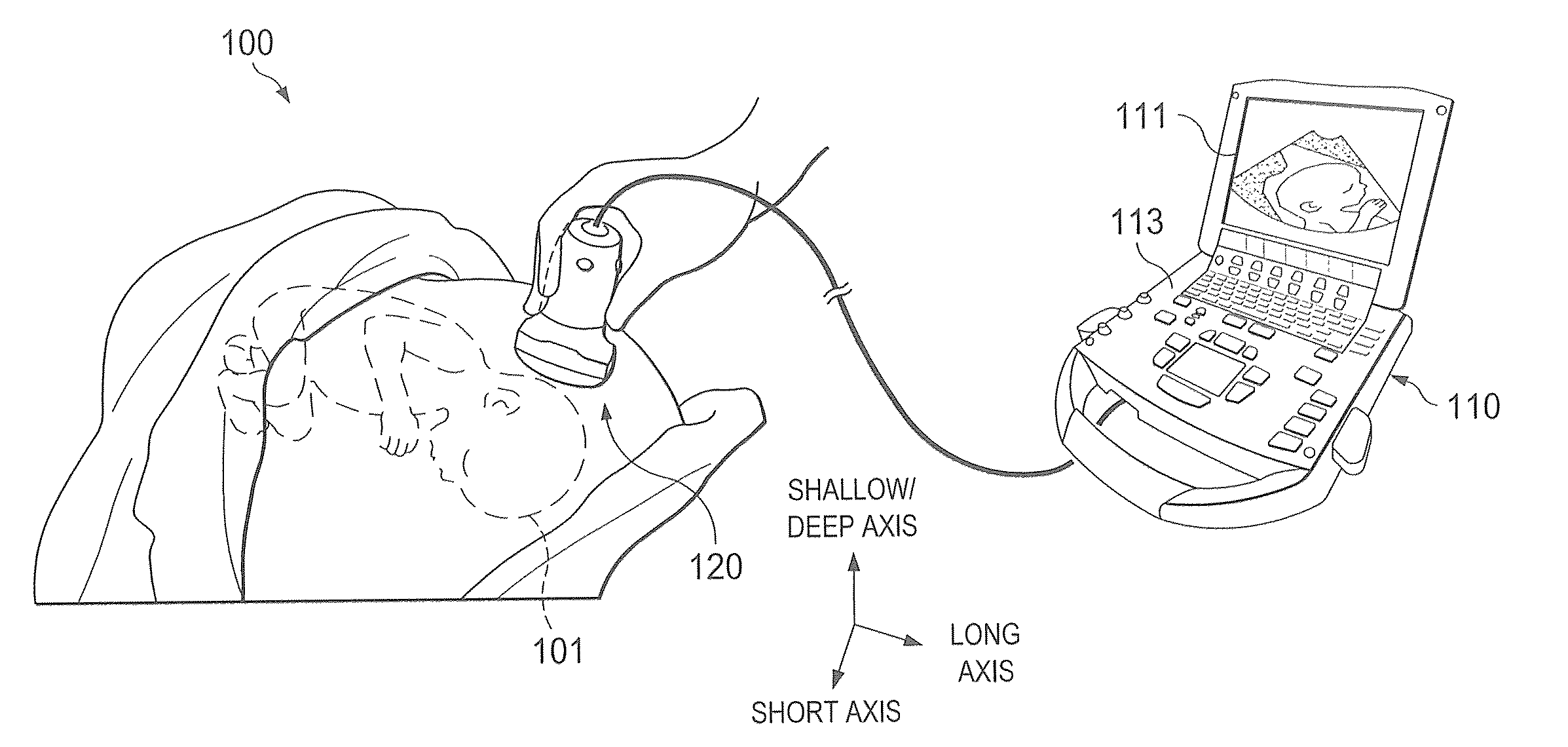 Systems and methods for adaptive volume imaging