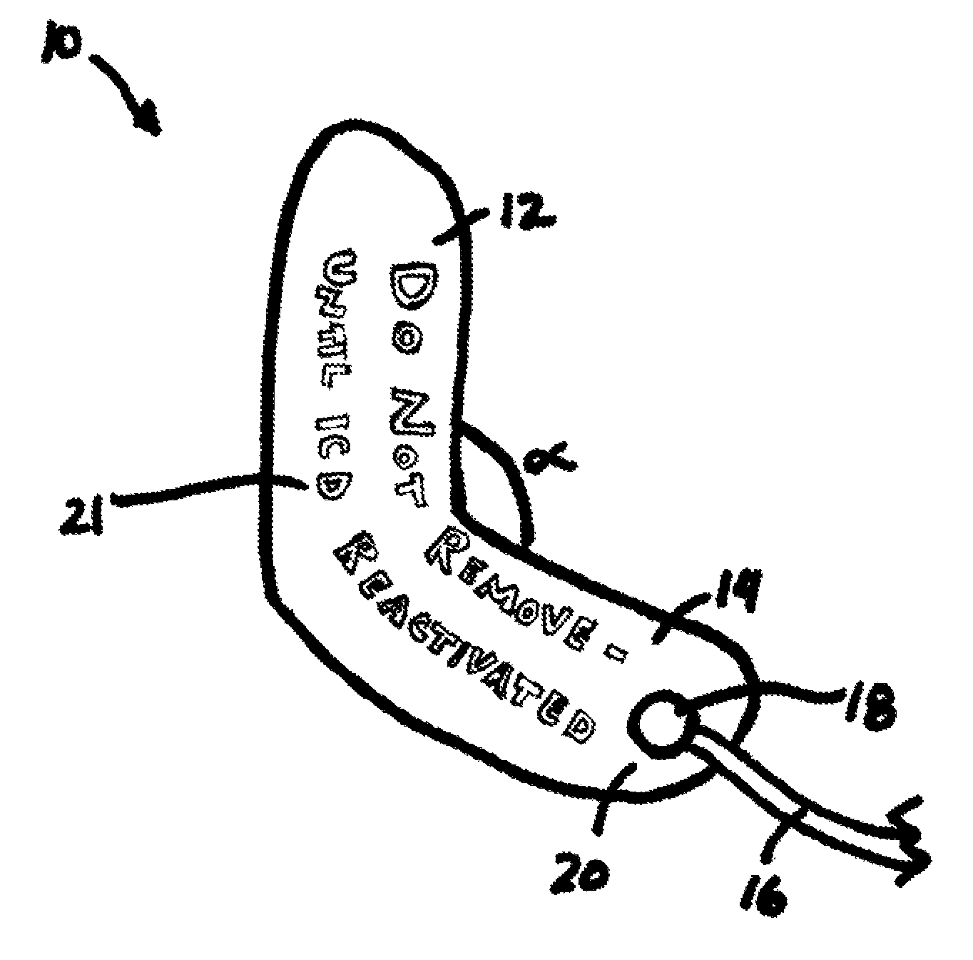 Automatic external defibrillator for implatable cardiac defibrillator patients undergoing procedures involving electromagnetic interference