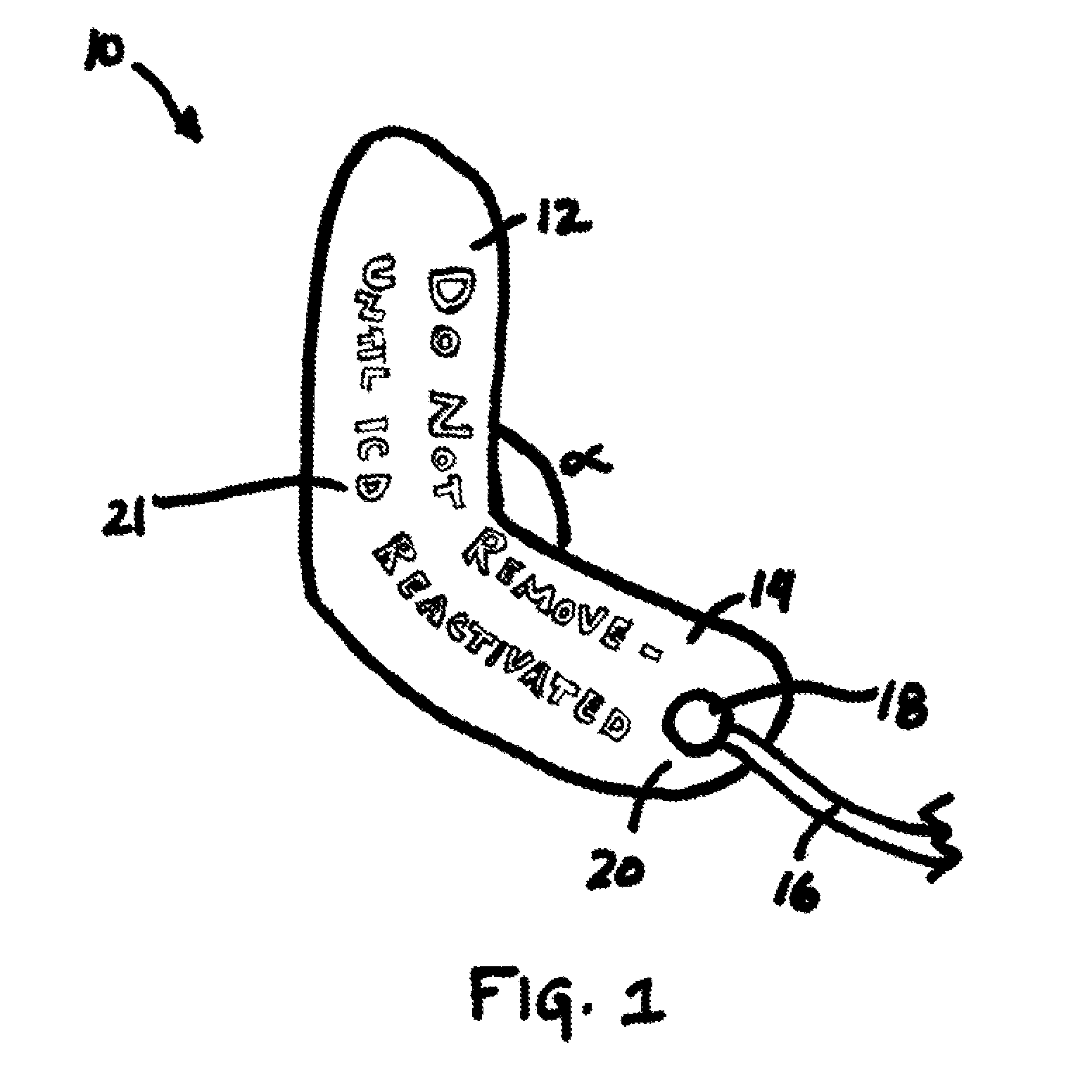 Automatic external defibrillator for implatable cardiac defibrillator patients undergoing procedures involving electromagnetic interference