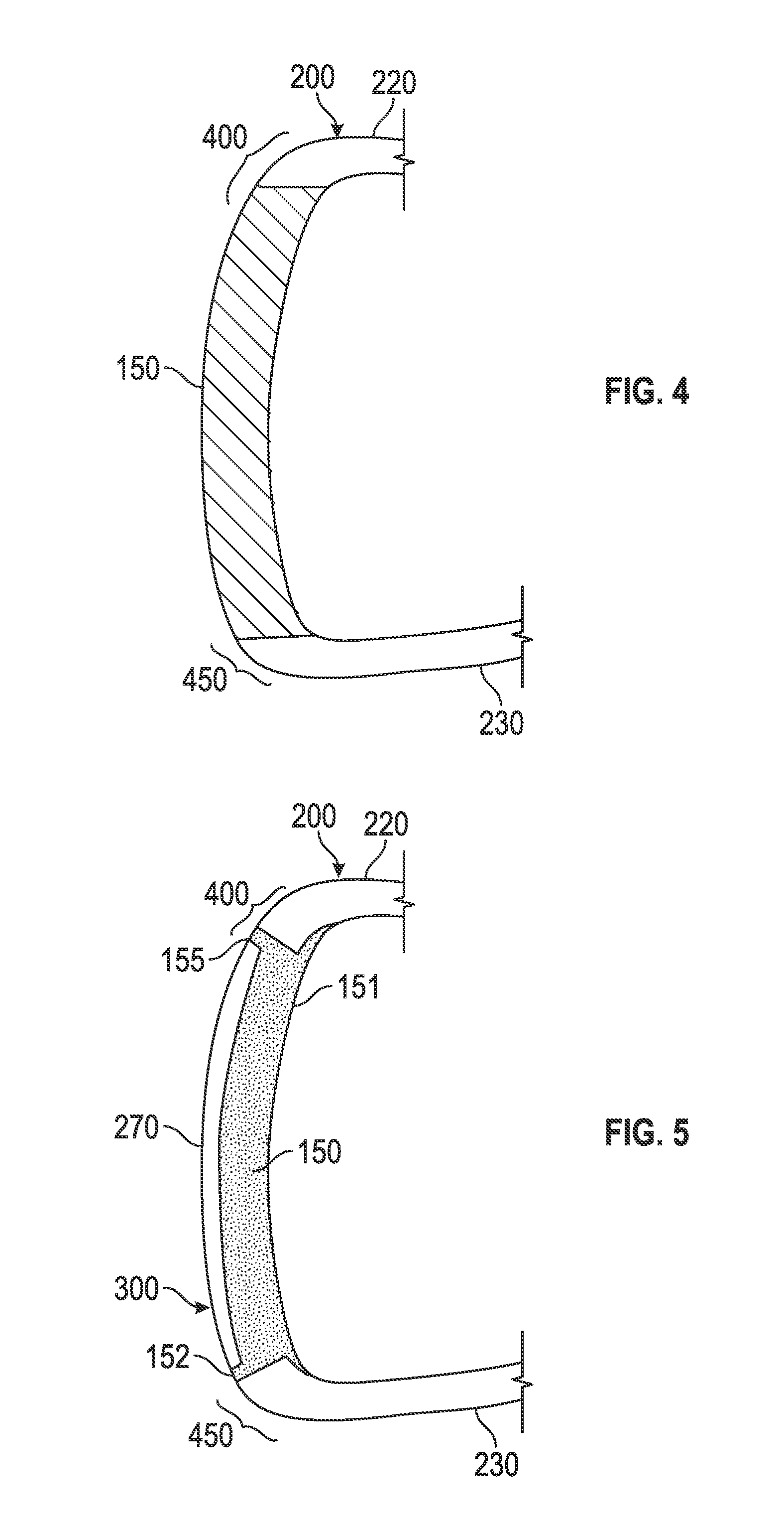 Golf club head with composite face