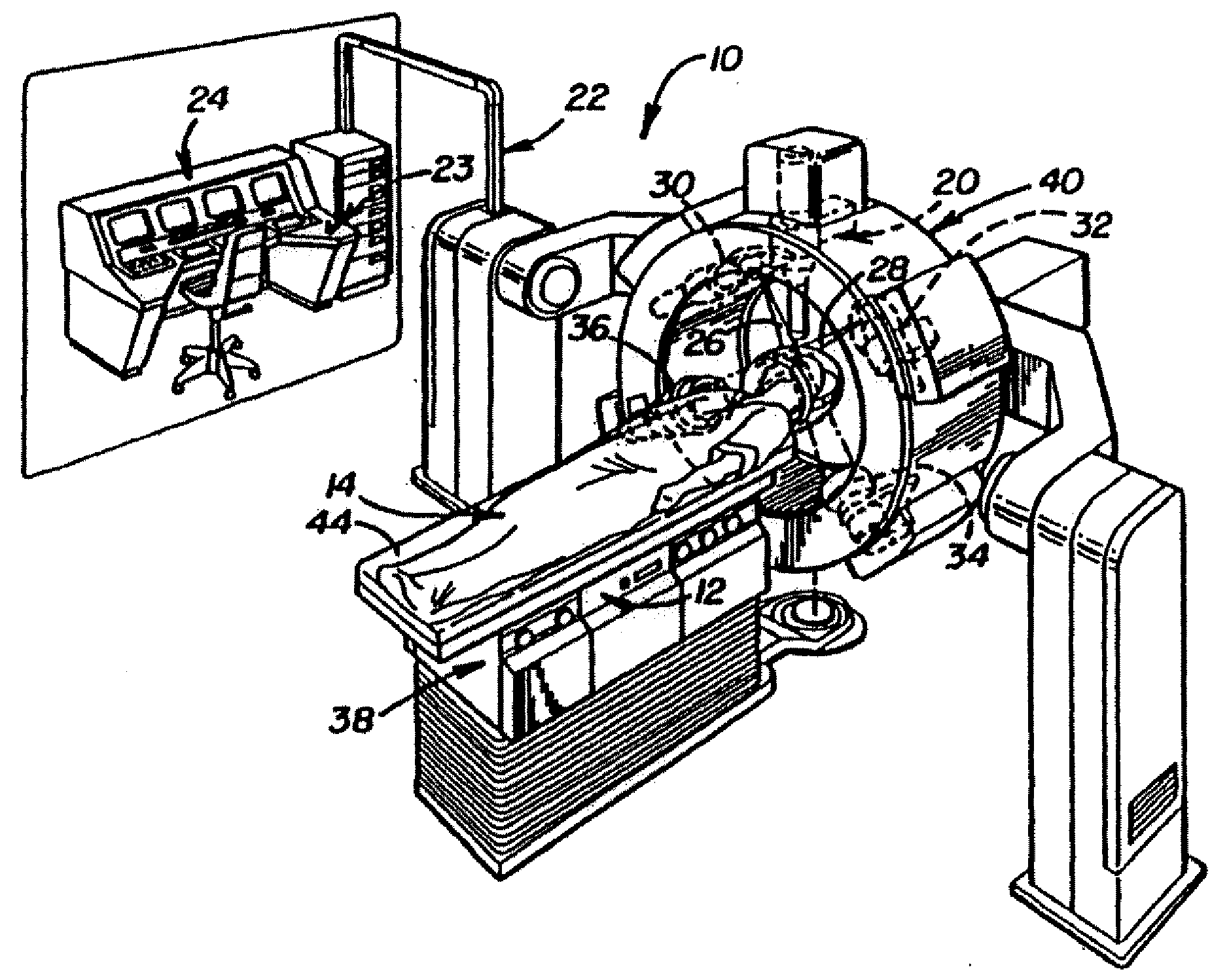 Frameless radiosurgery treatment system and method