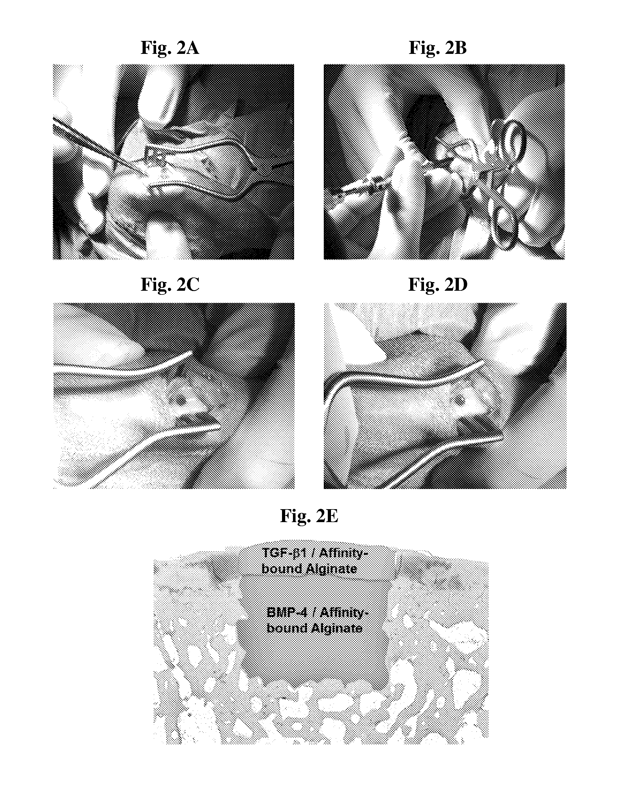 Hydrogel system comprising spatially separated bioactive polypeptides