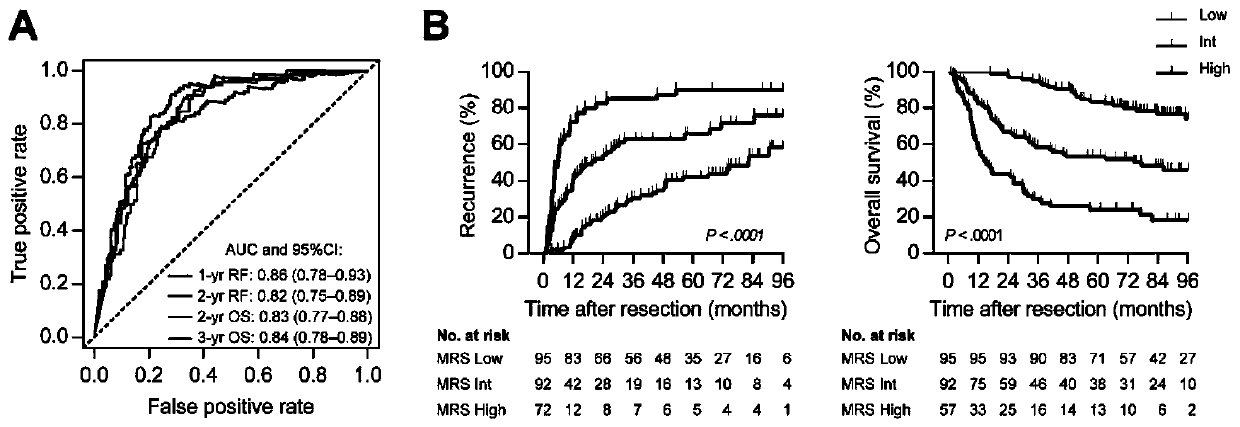 Marker for prognosis prediction of liver cancer based on CD11b and CD169 protein molecules