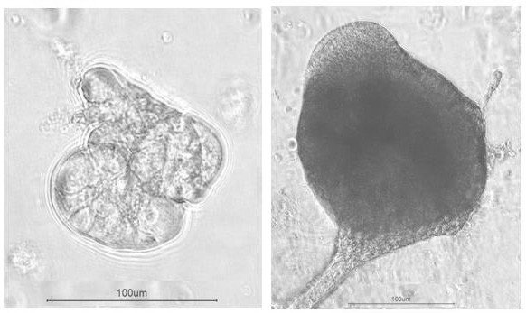 Construction method of mature stable organoid