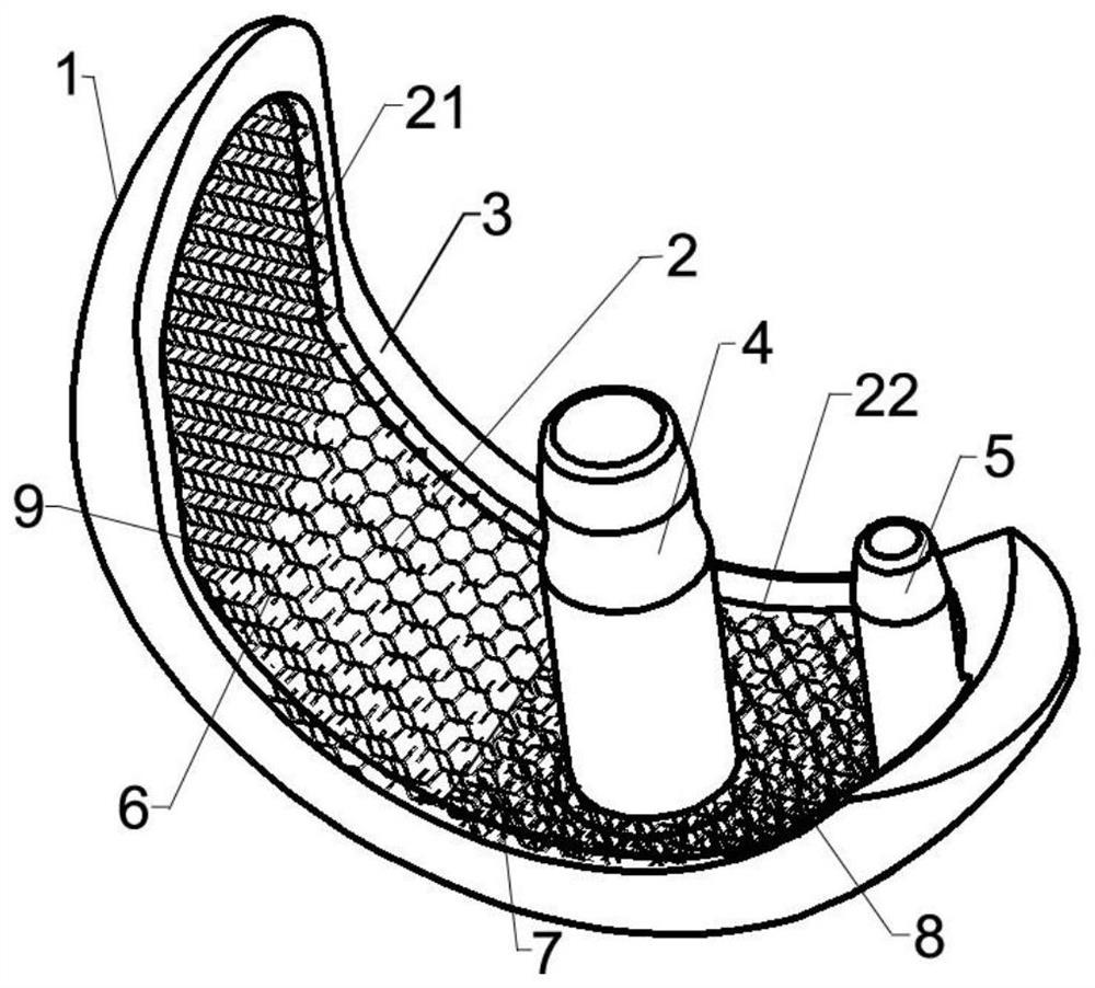 Zirconium-niobium alloy partitioned bone trabecula single-compartment femoral condyle containing oxide layer and preparation method