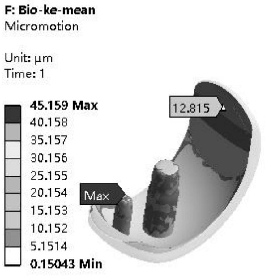 Zirconium-niobium alloy partitioned bone trabecula single-compartment femoral condyle containing oxide layer and preparation method