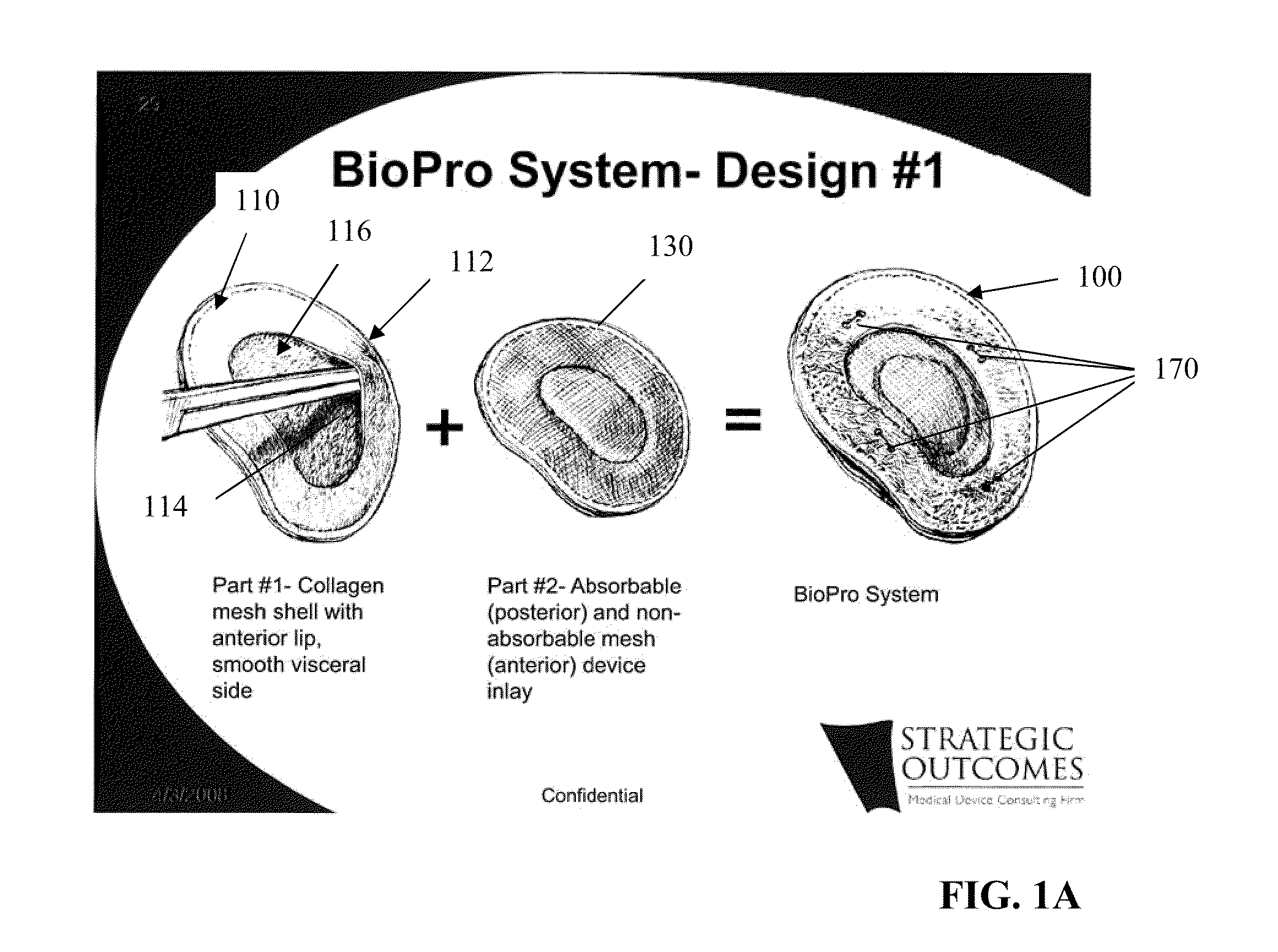 Tissue Reconstruction Devices and Methods