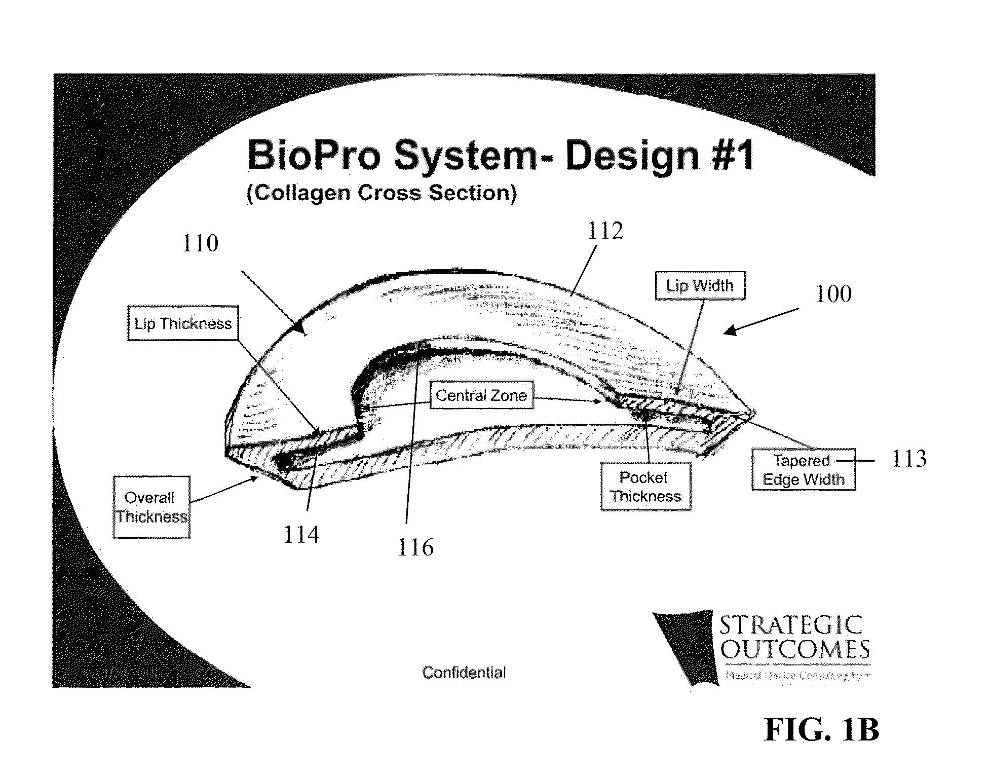 Tissue Reconstruction Devices and Methods