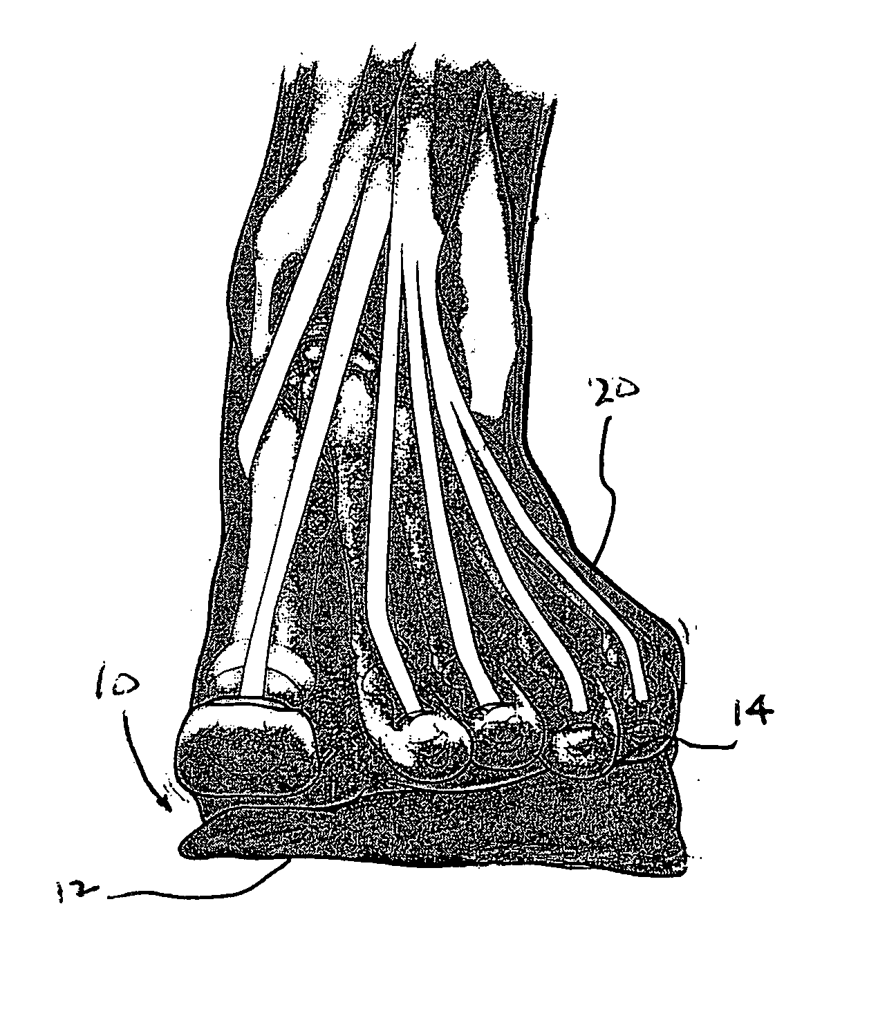 Device for promoting reflective neuromuscular training