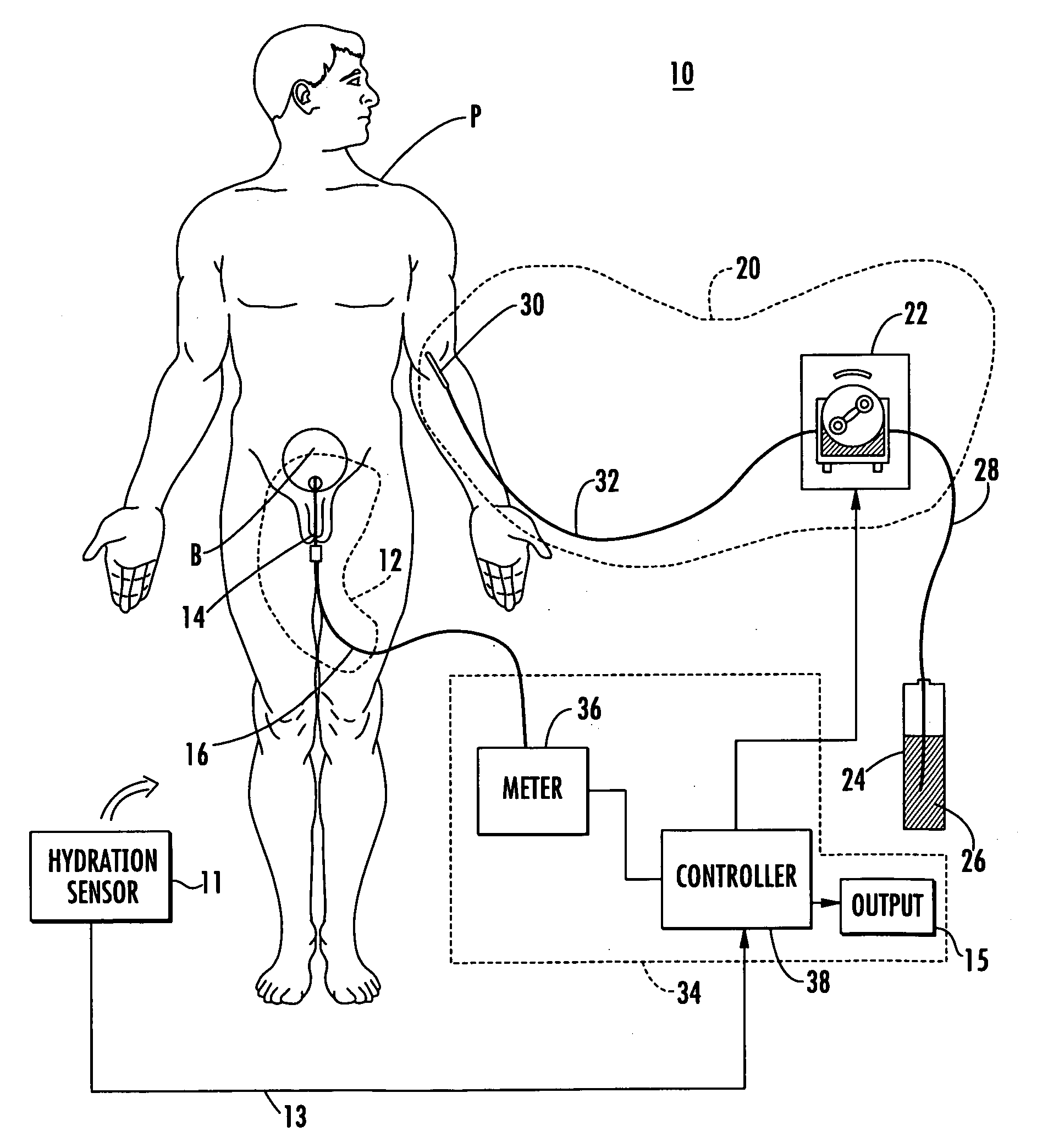 Patient hydration system with hydration state detection