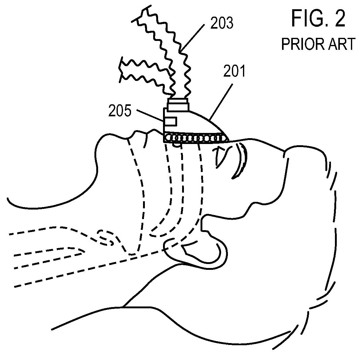 Methods, systems and devices for non-invasive ventilation including a non-sealing ventilation interface with a free space nozzle feature