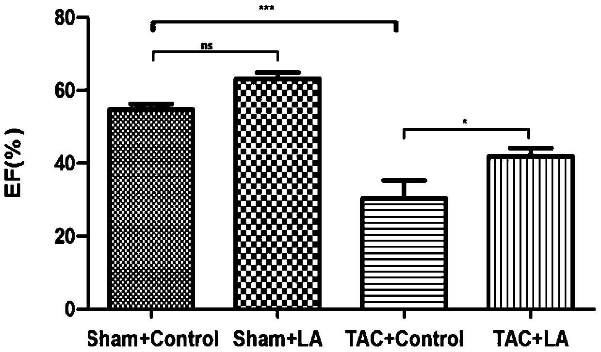 Application of Lipoic Acid in Preparation of Pharmaceutical Composition for Treating Pressure Load Myocardial Injury