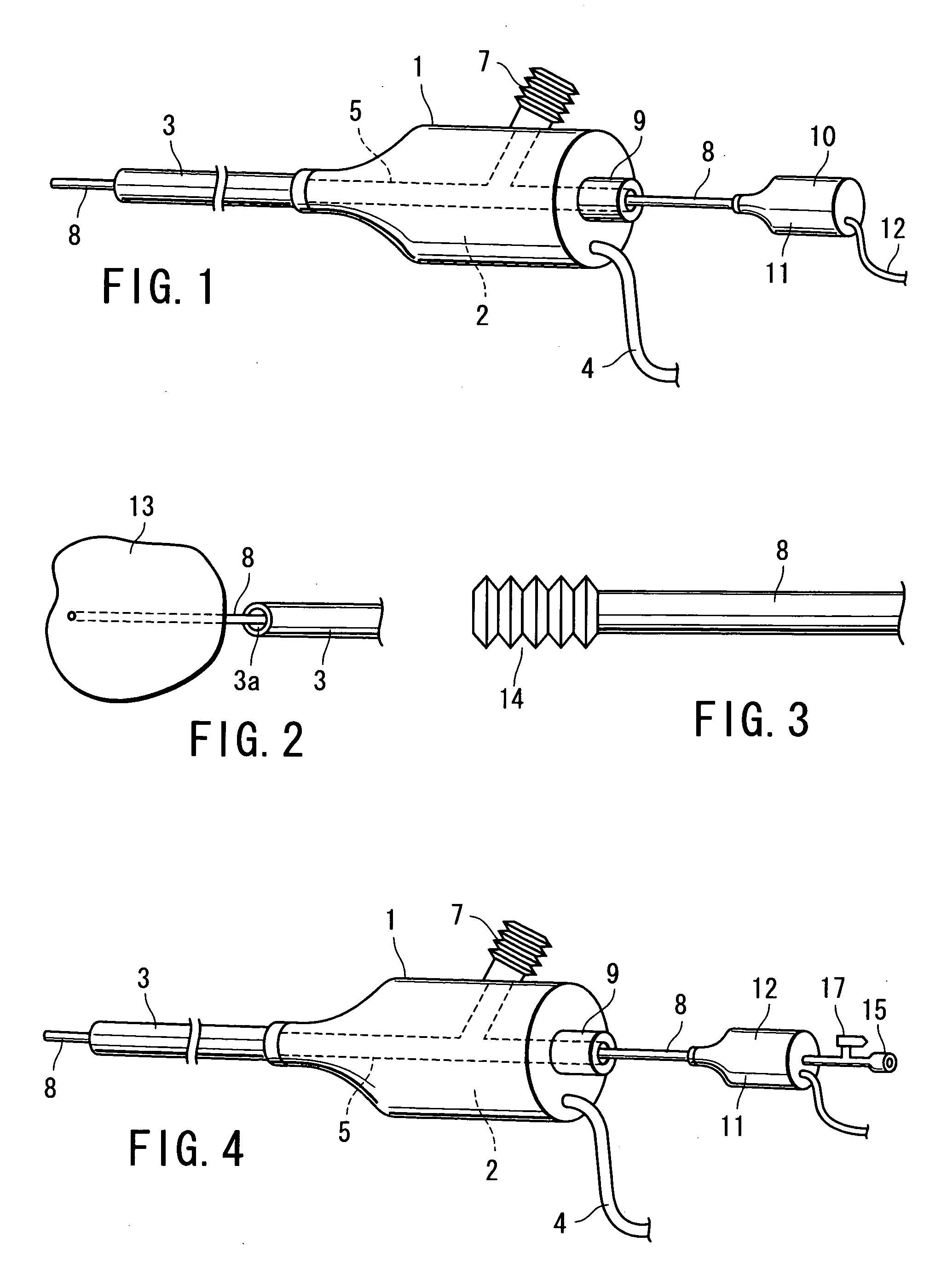 Calculus manipulation apparatus