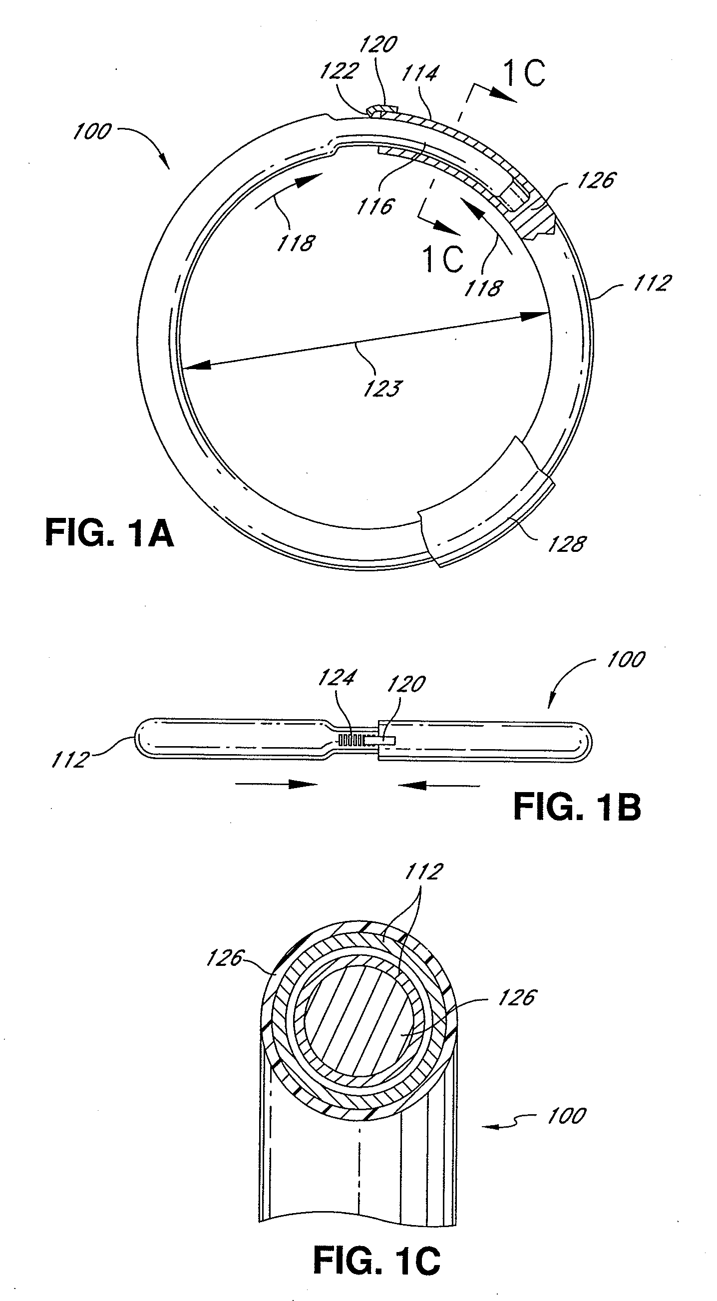 Adjustable annuloplasty ring and activation system