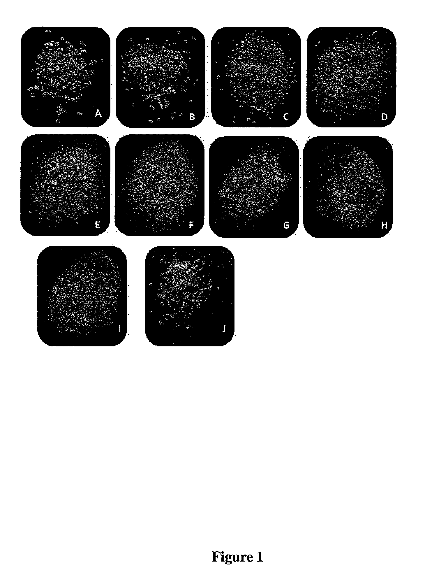 Cryopreservation of cells, tissues and organs