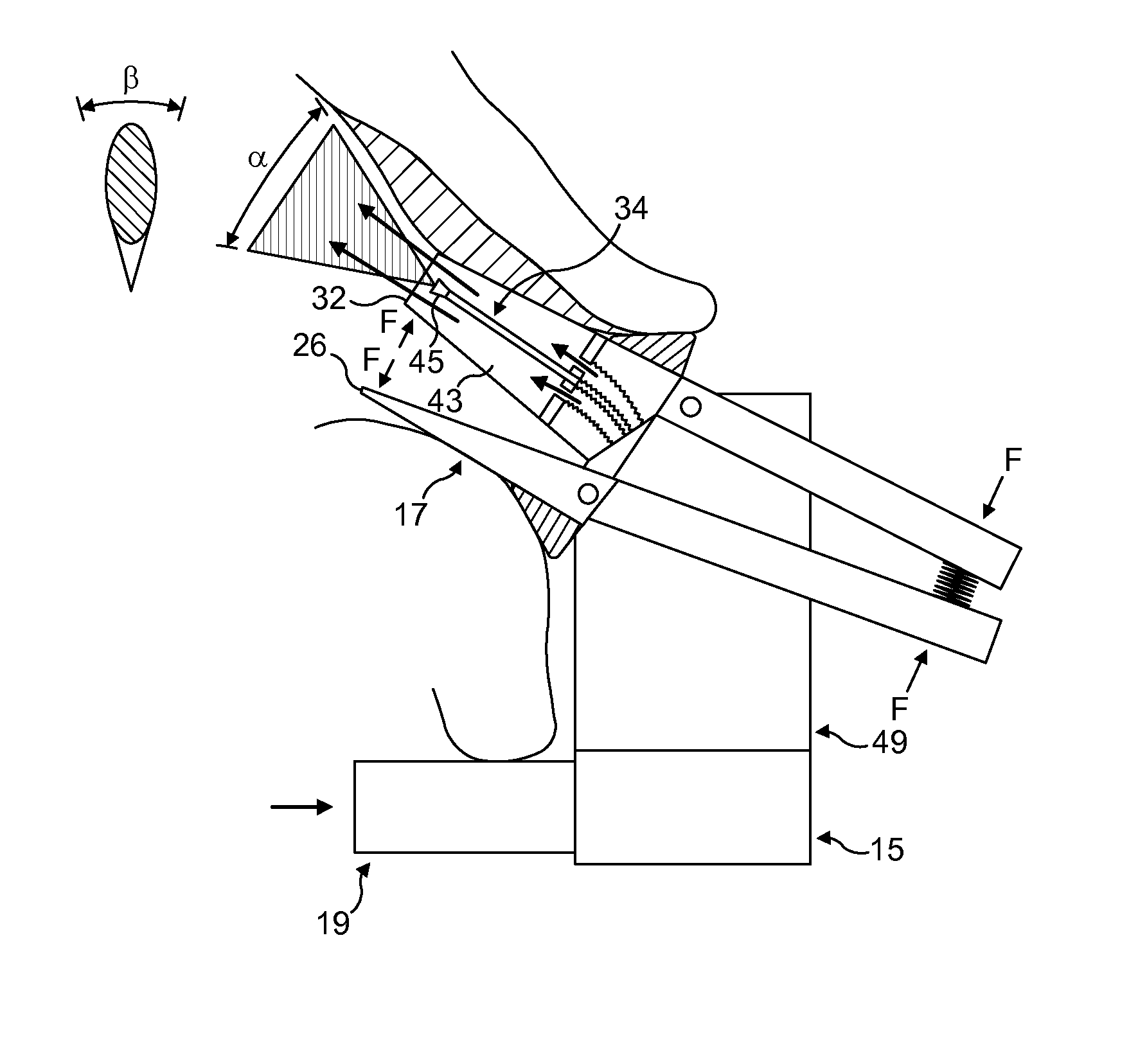 Nasal delivery