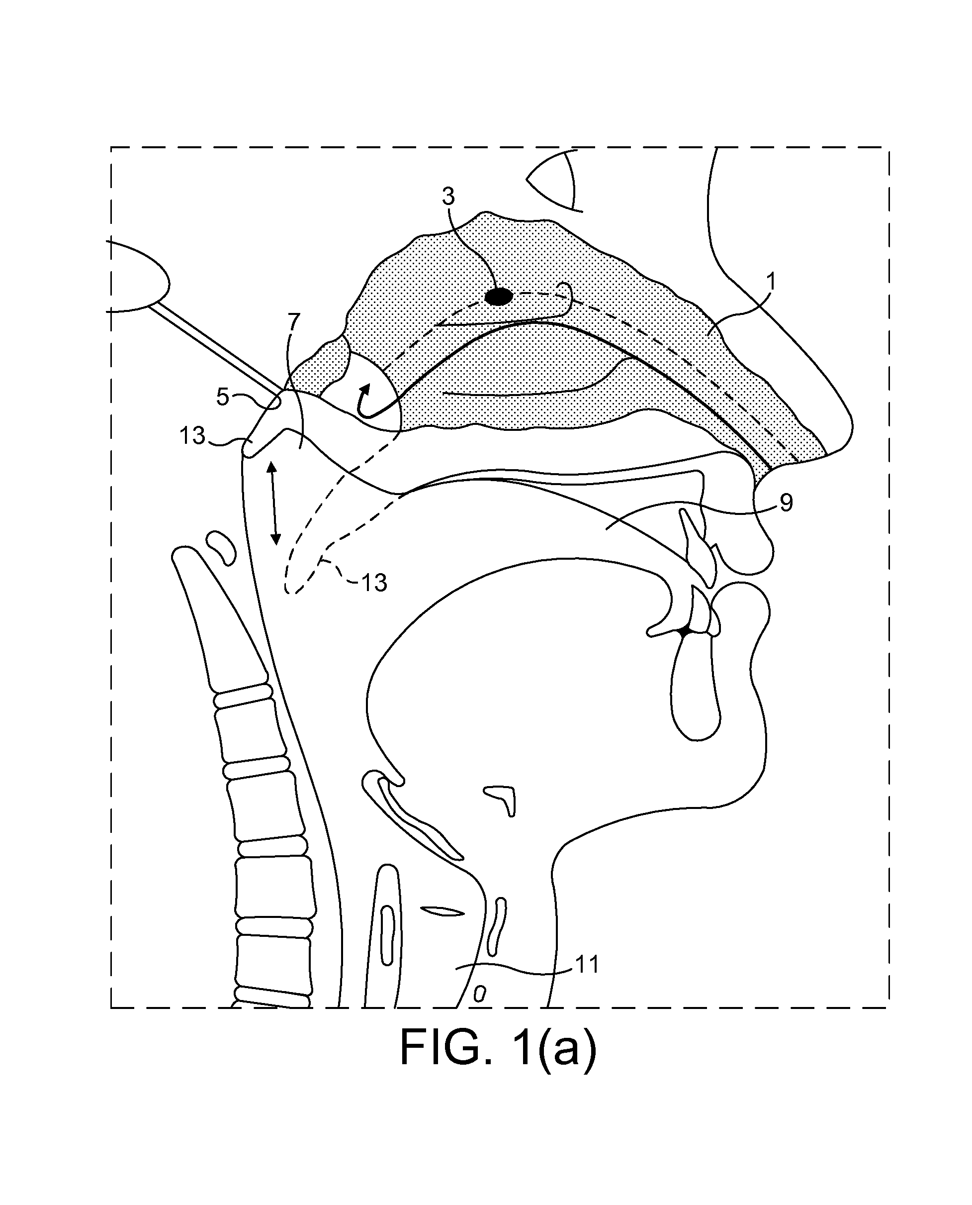 Nasal delivery