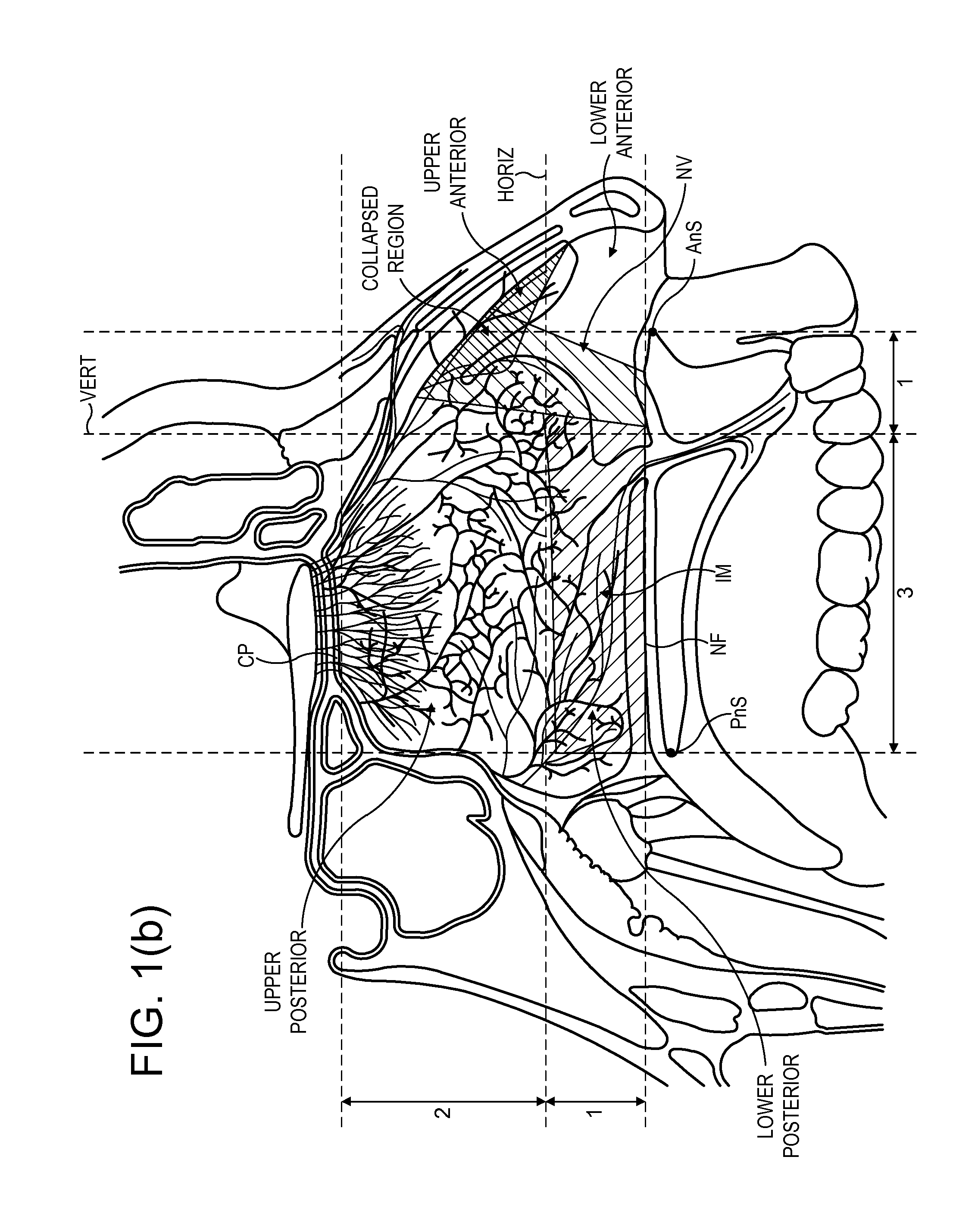 Nasal delivery