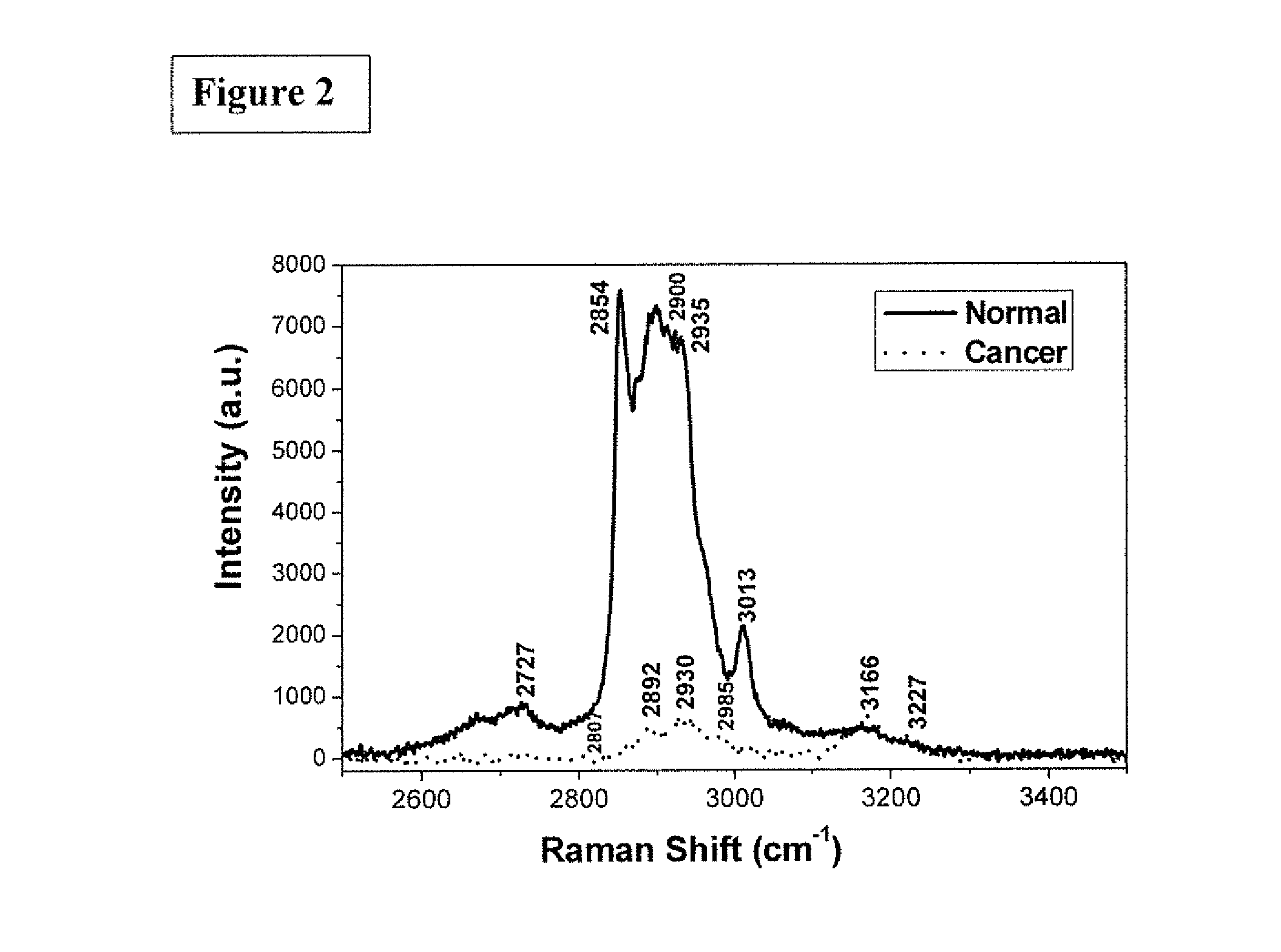 Resonance raman spectroscopy analyzer instrument for biomolecules in tissues and cells