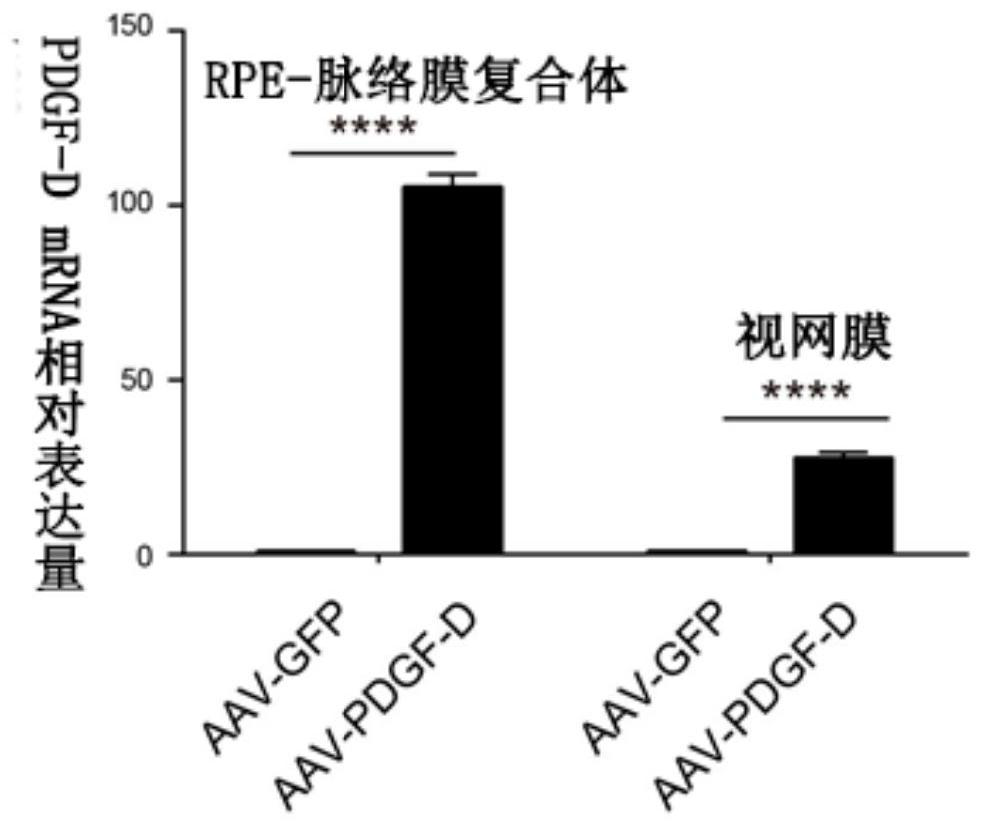 Method and preparation for regulating complement system, and use thereof