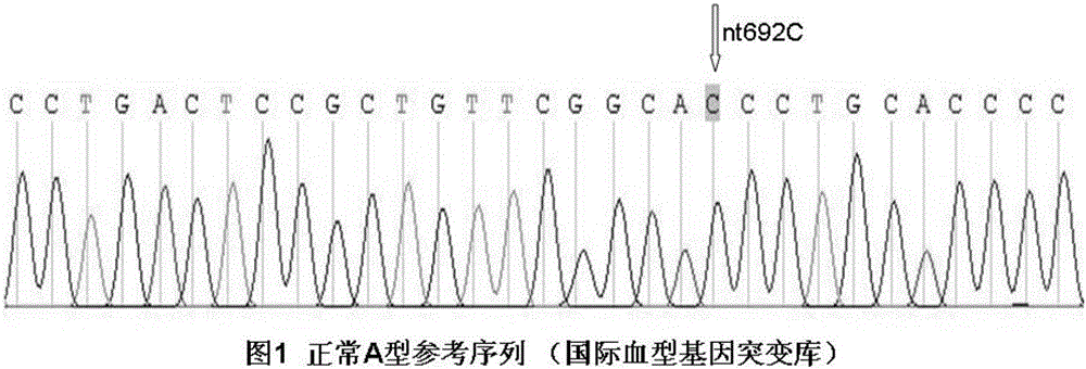 Single-nucleotide polymorphism locus of ABO blood variant inducing hemolytic transfusion reaction