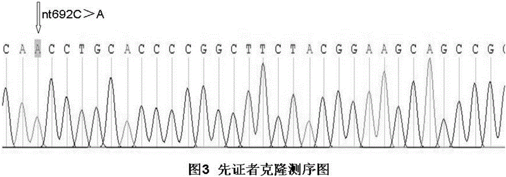 Single-nucleotide polymorphism locus of ABO blood variant inducing hemolytic transfusion reaction