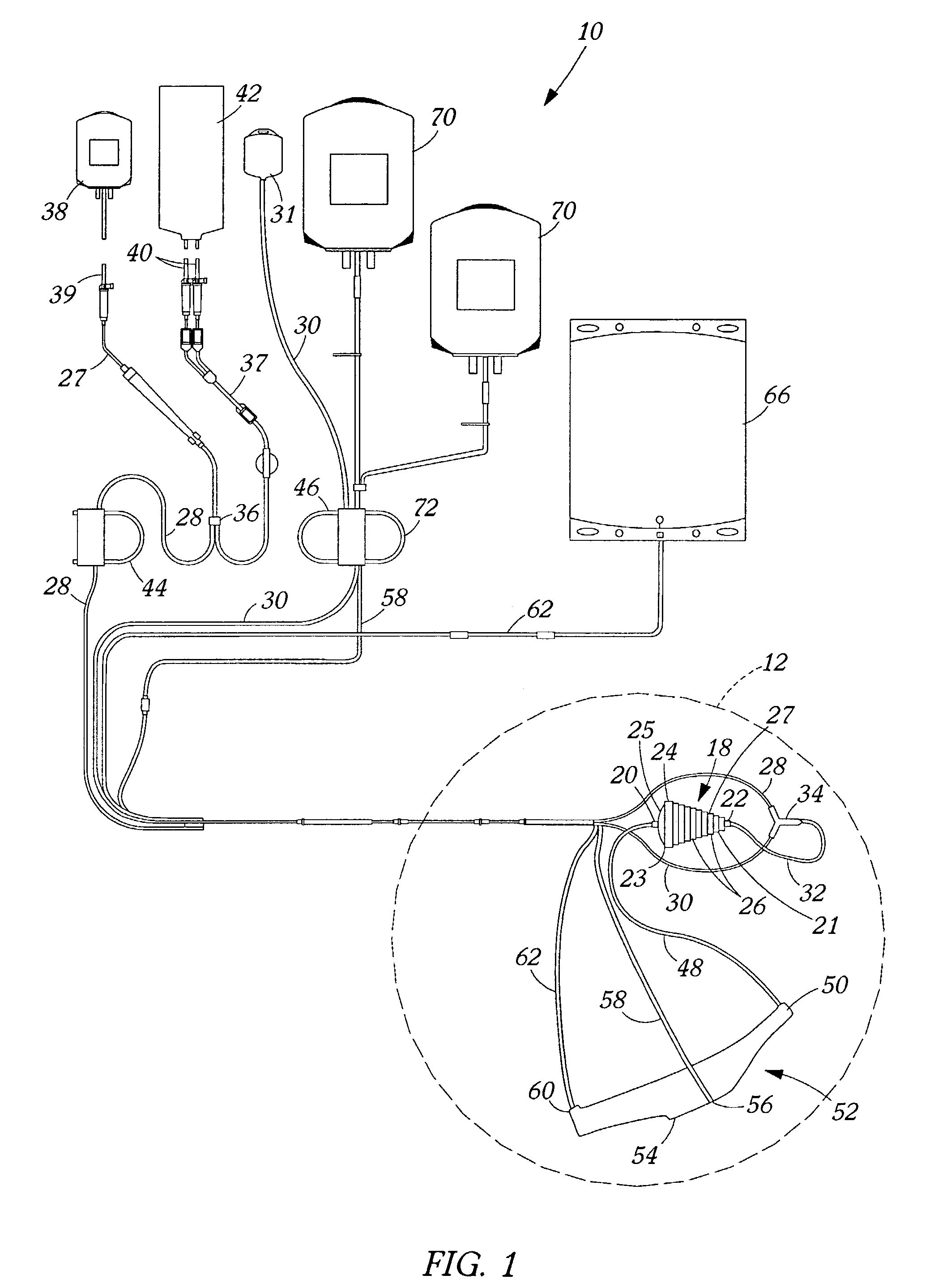 Methods and apparatus for separation of particles