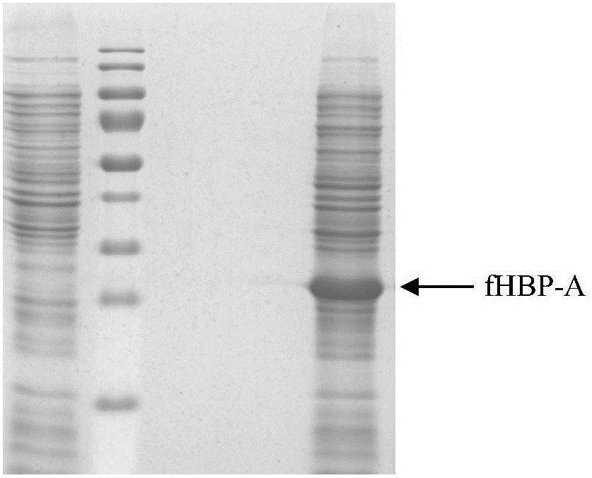 Group ABC meningococcus combined vaccine and preparing method thereof