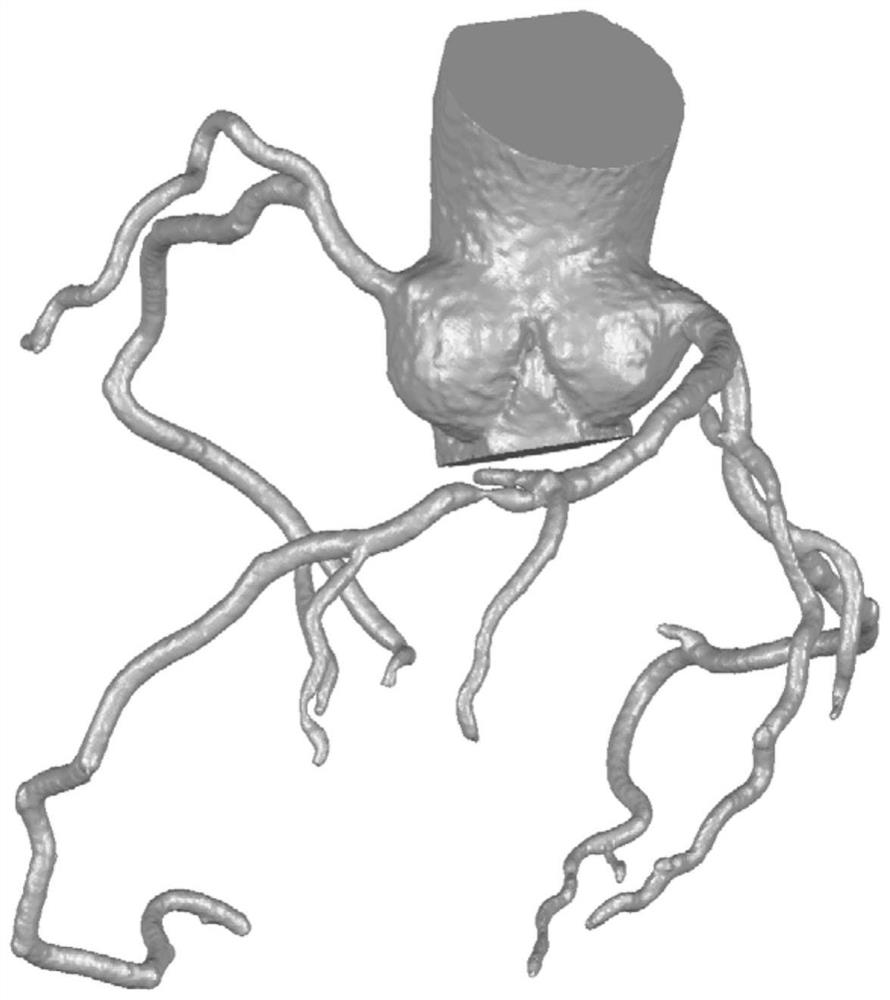 The system, method, equipment and storage media of the blood flow reserve score