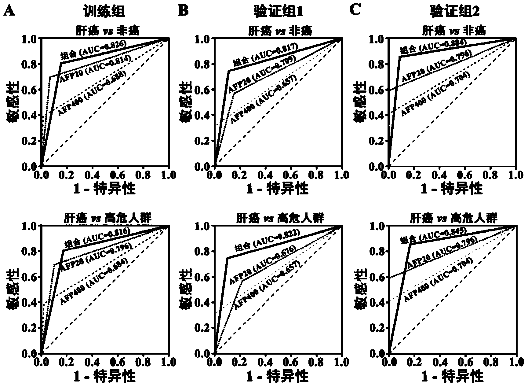 Liver cancer diagnosis markers composed of serum microRNA (microribonucleic acid) and diagnosis kit