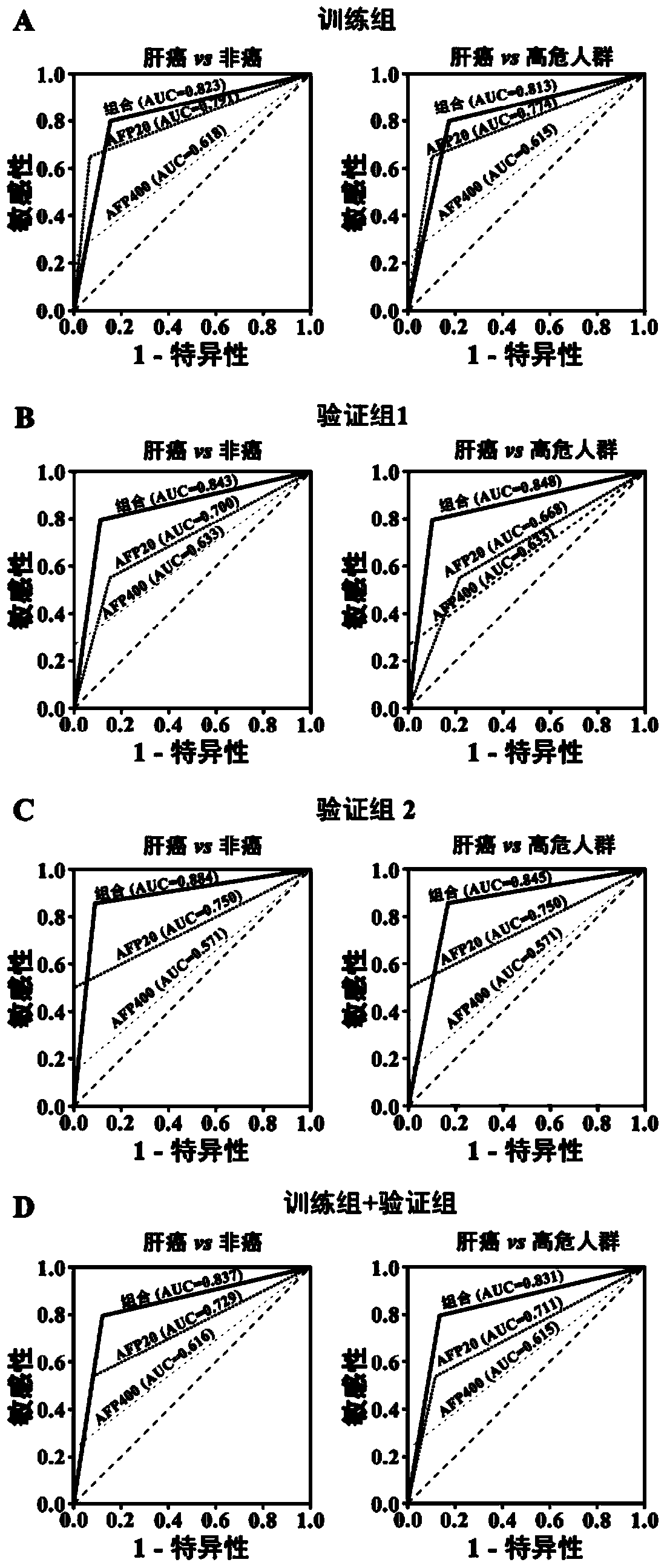 Liver cancer diagnosis markers composed of serum microRNA (microribonucleic acid) and diagnosis kit