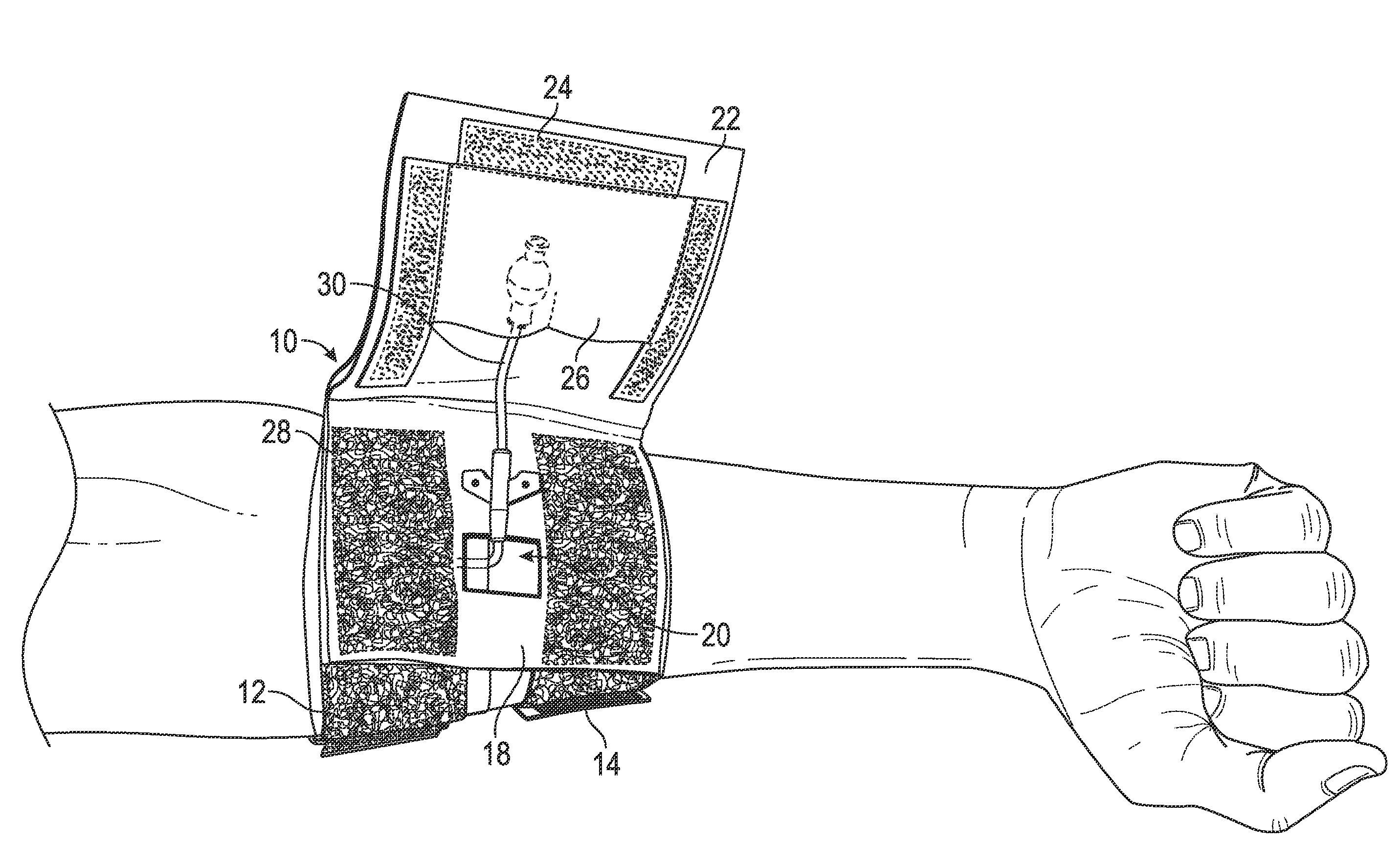 Protection and securing apparatus for externally protruding medical tubes