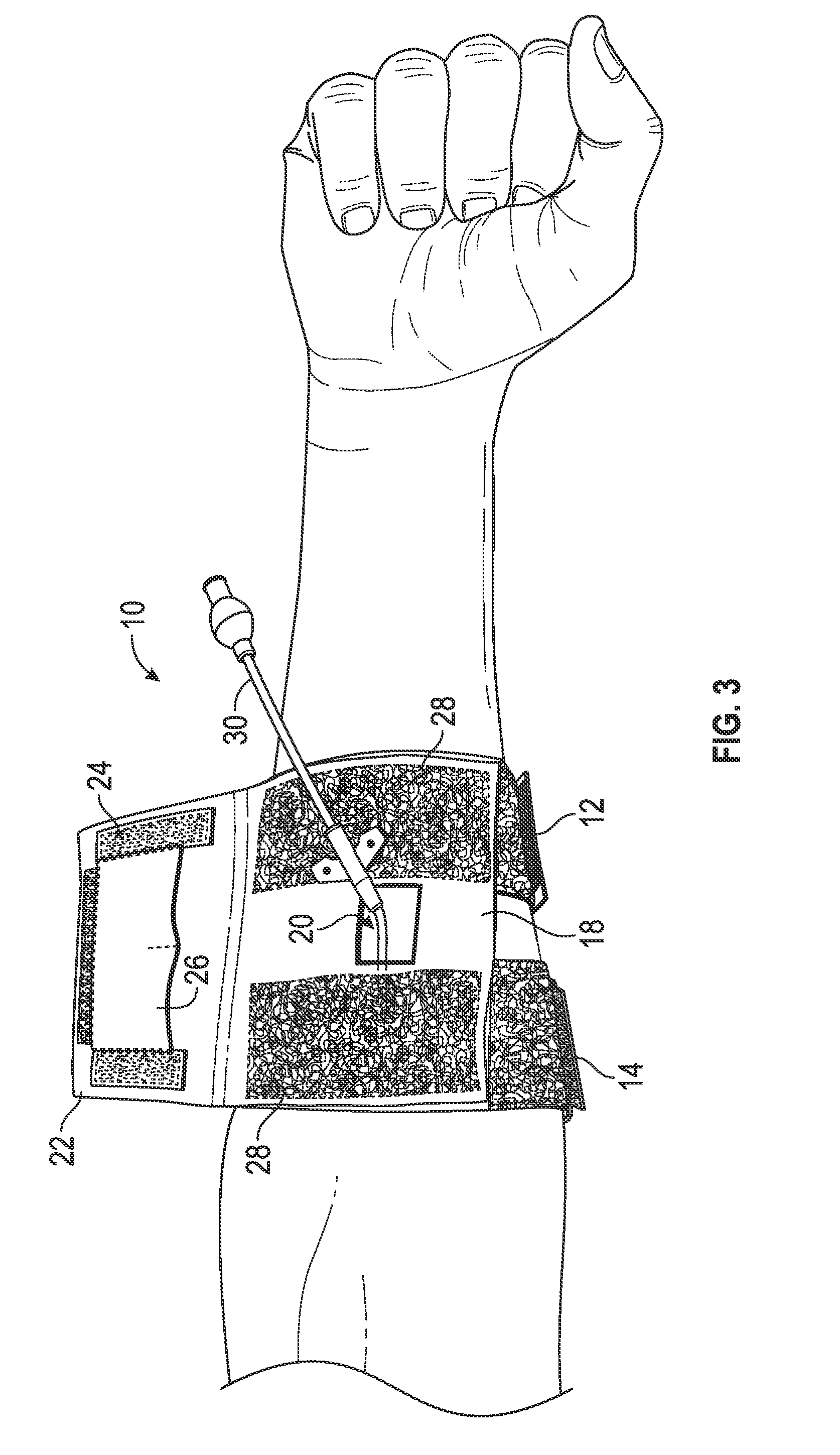 Protection and securing apparatus for externally protruding medical tubes