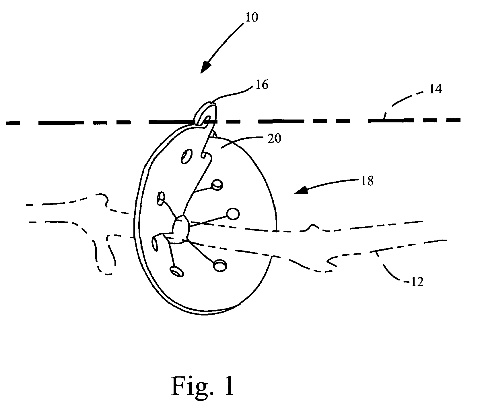 Vegetation attachment device