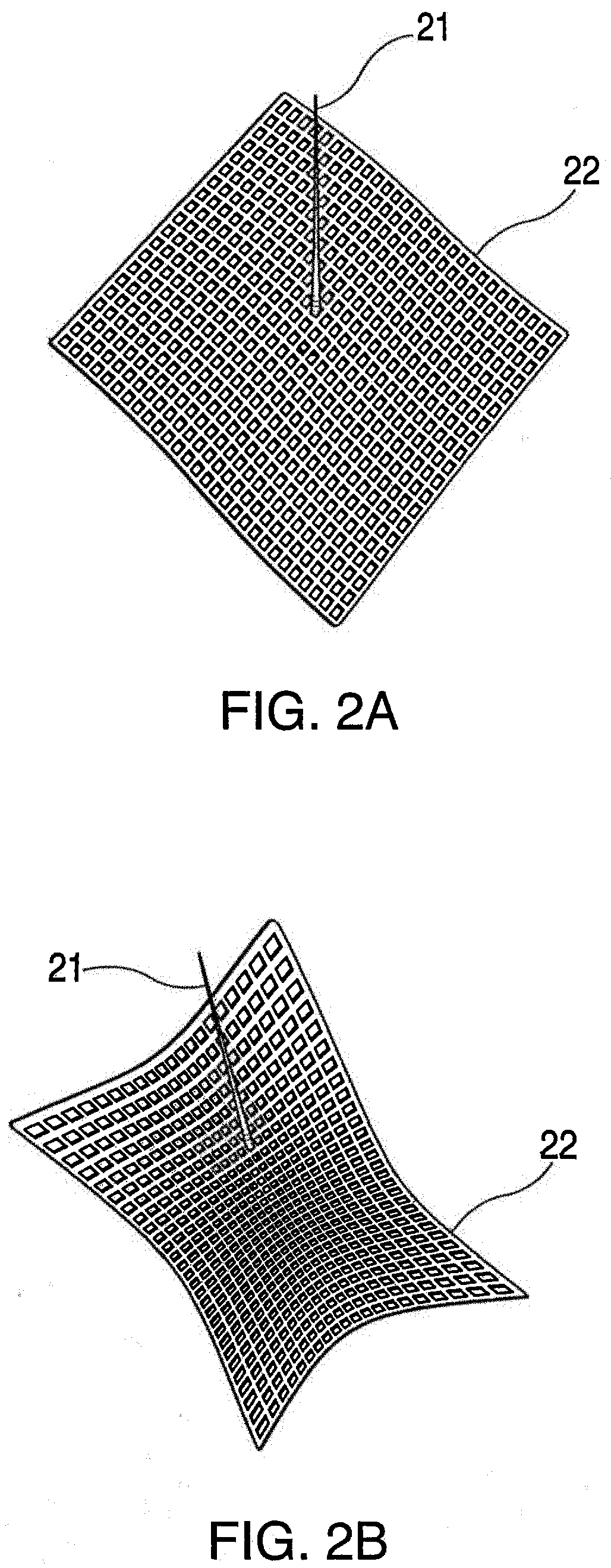 Pre-angioplasty serration of atherosclerotic plaque enabling low pressure balloon angioplasty & avoidance of stenting