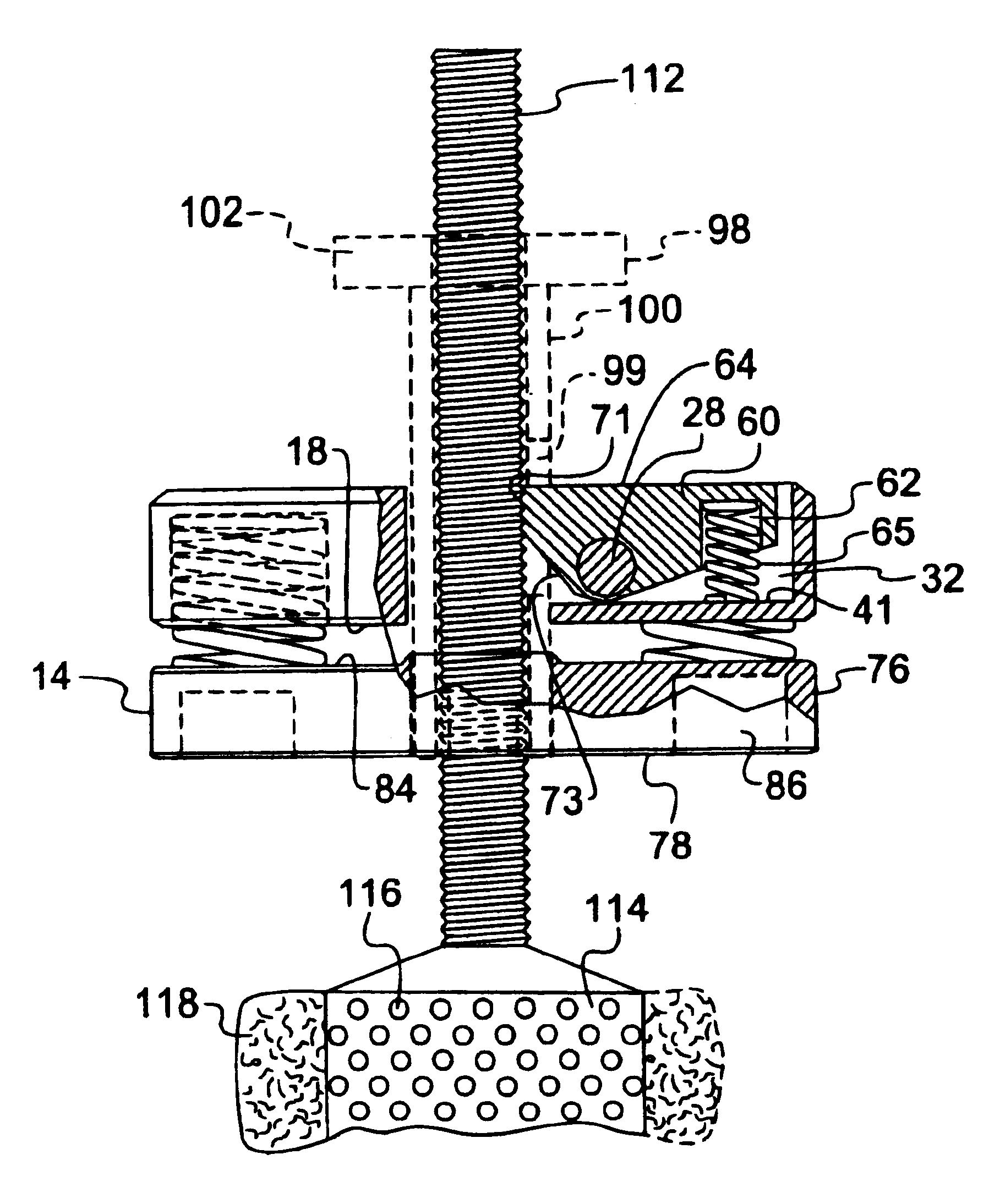 Quick-release lock assembly with compression/expansion capability