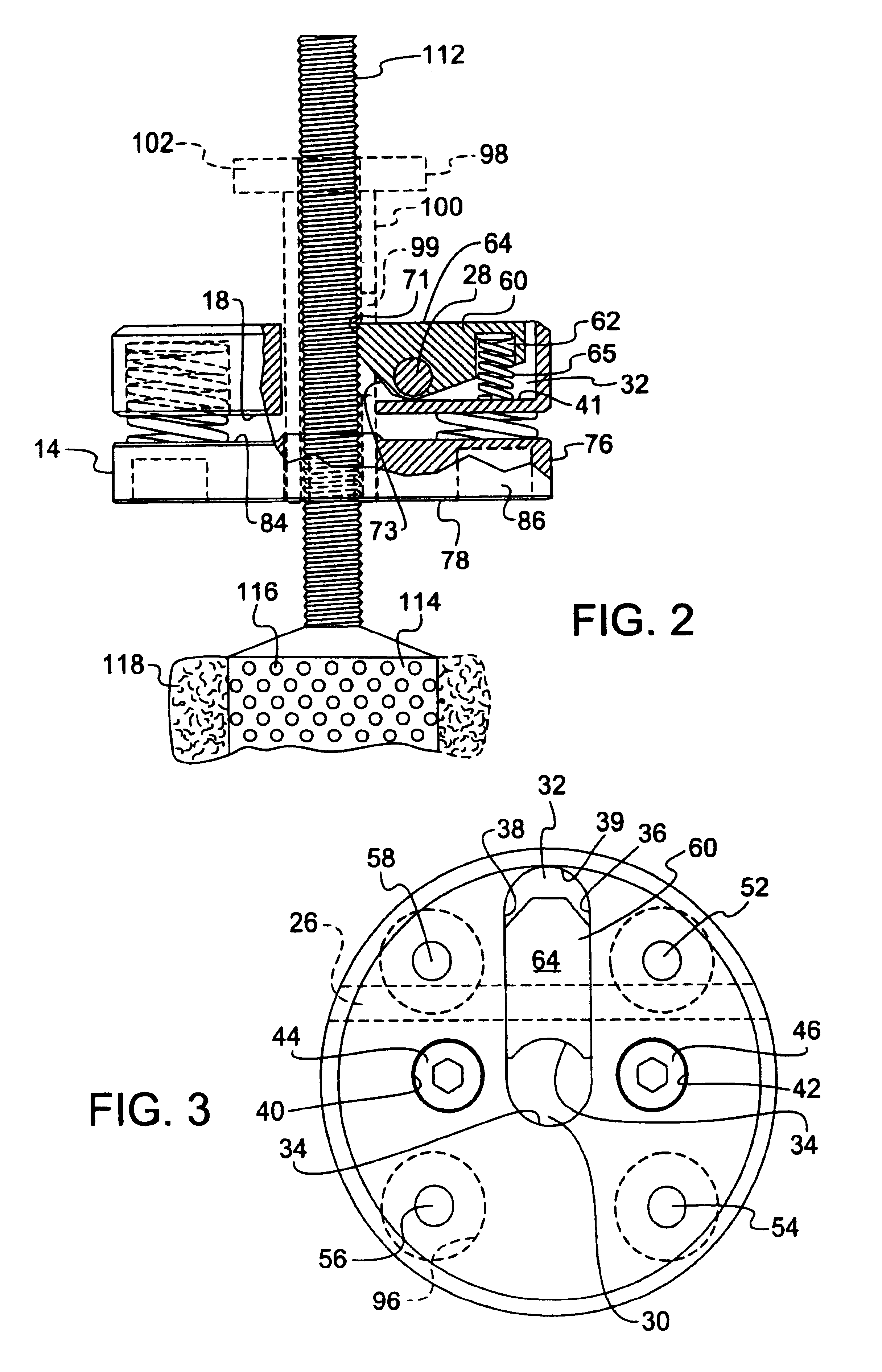 Quick-release lock assembly with compression/expansion capability