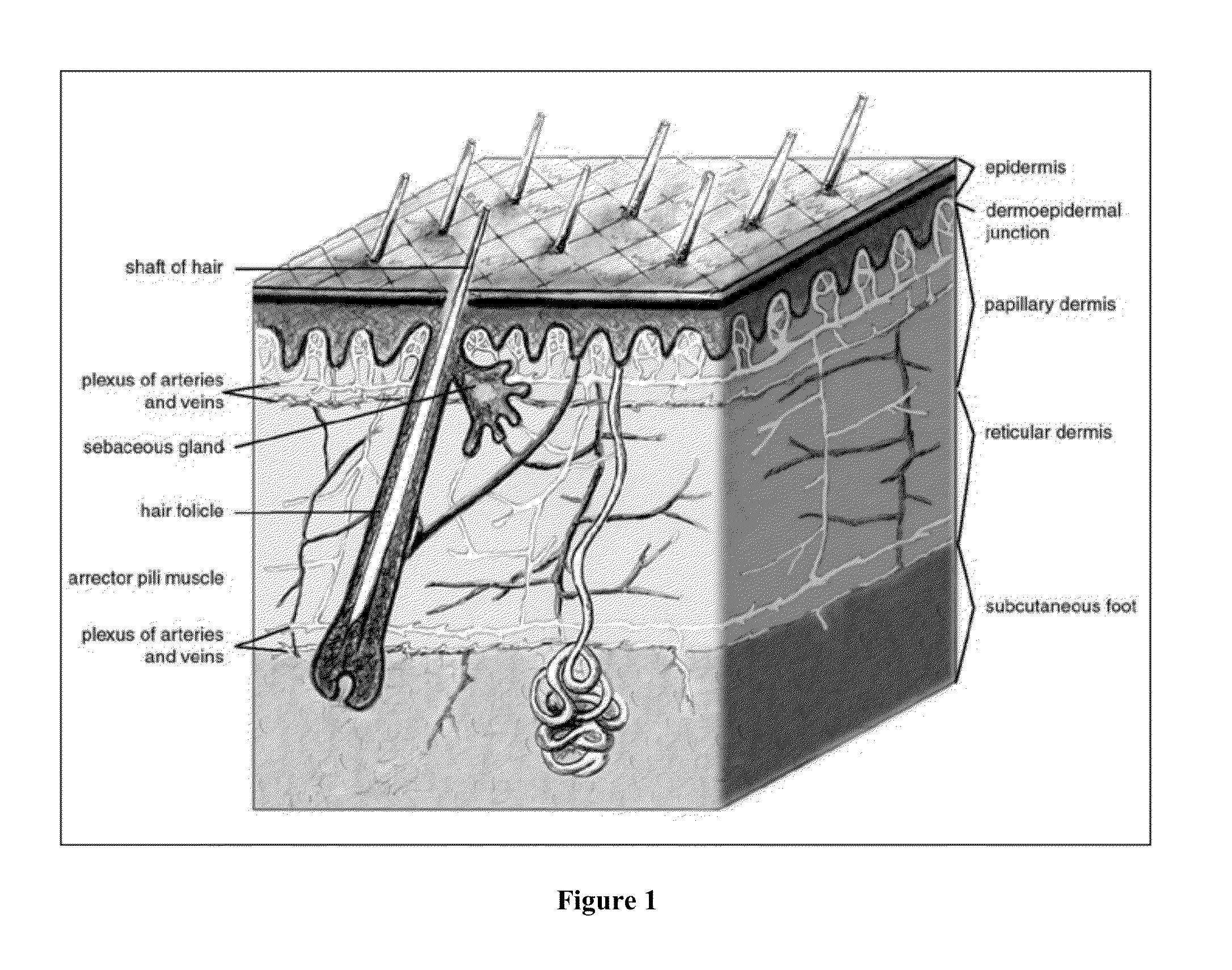 Methods of manufacturing devices for generating skin grafts