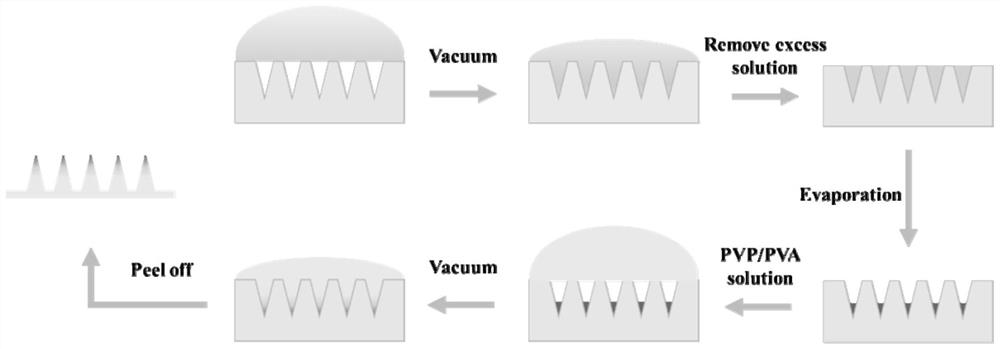 Preparation method of soluble microneedle patch constructed based on graphene quantum dots and used for treating bacterial keratitis