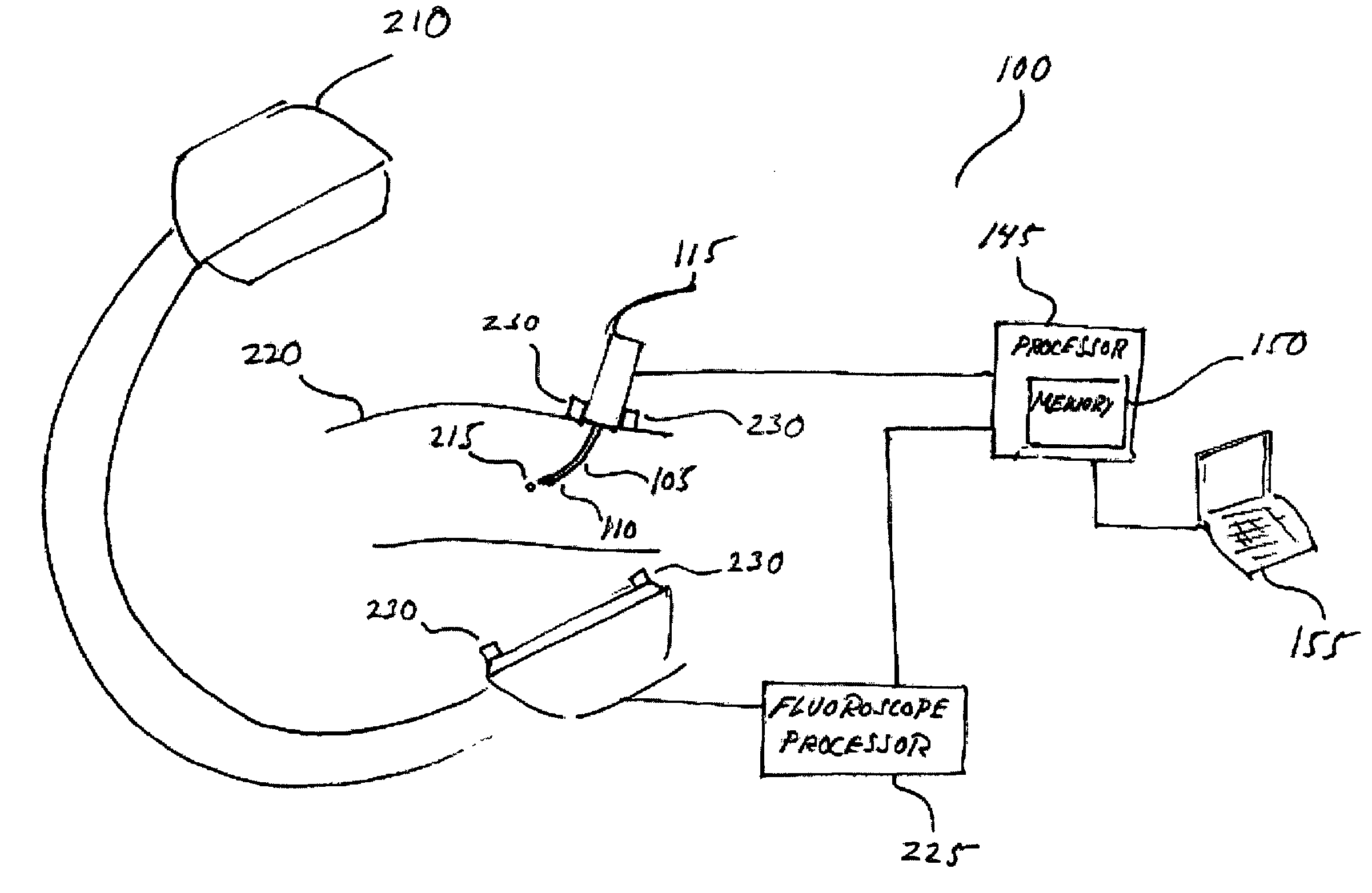 Distal bevel-tip needle control device and algorithm