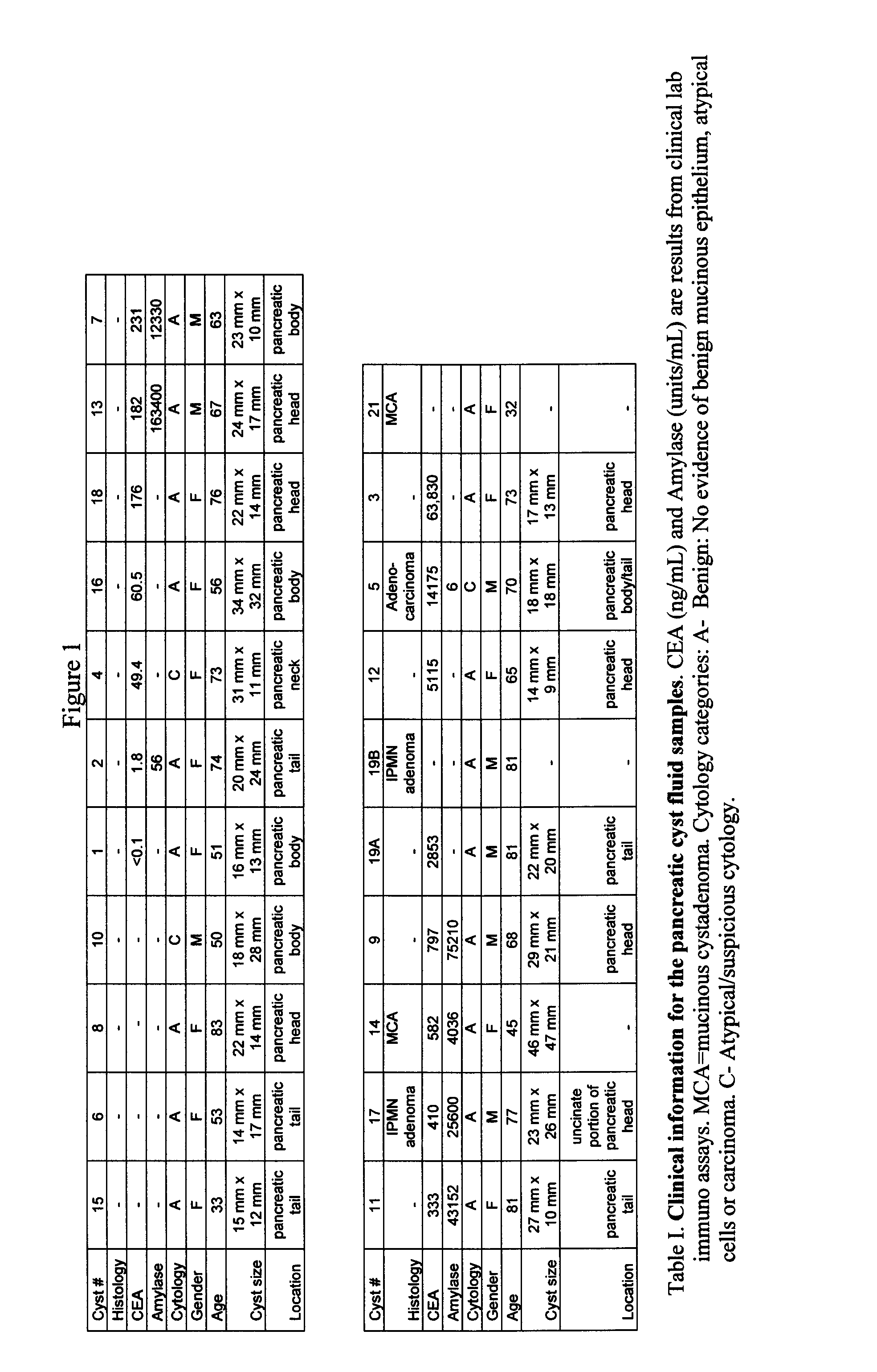 Biomarkers for the diagnosis and treatment of pancreatic cancer