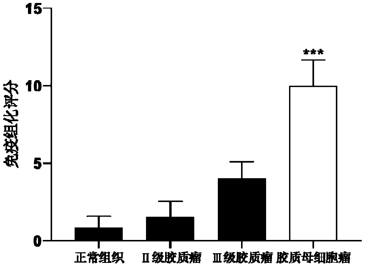 Application of VMP1 gene in pathological diagnosis of glioblastoma and preparation of kit thereof