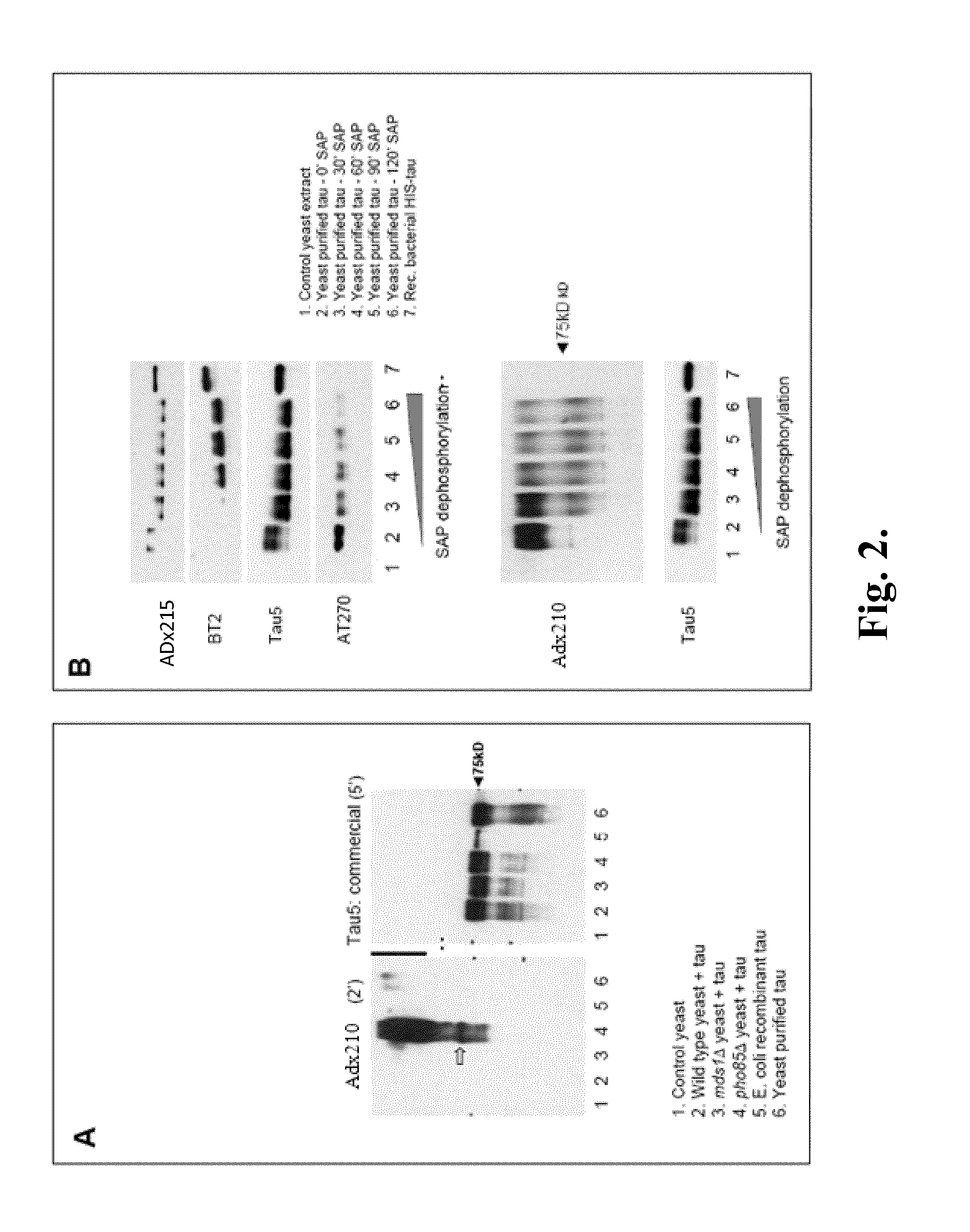 Antibodies to phosphorylated tau aggregates