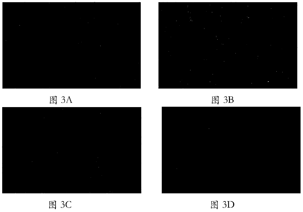 Human diploid cell ZFB as well as construction method and large-scale culture method thereof