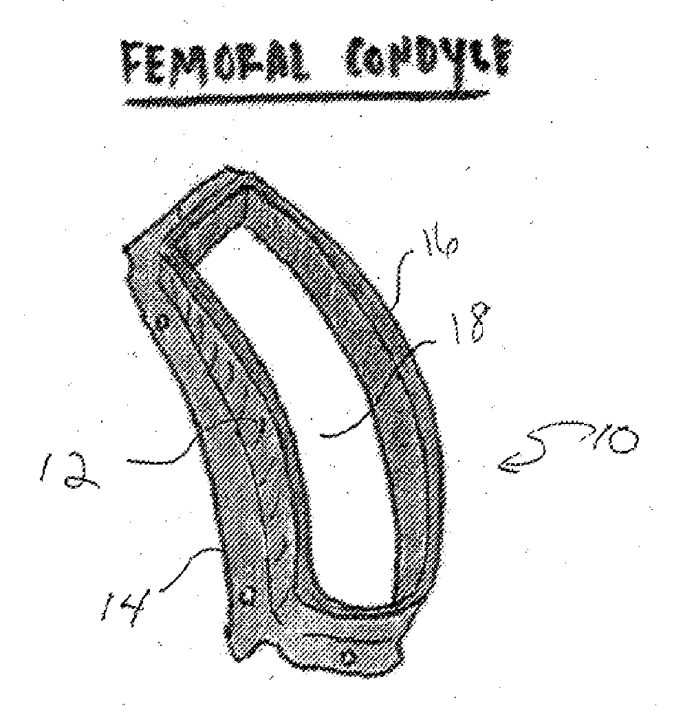 System and method for three dimensional printed implantation guides