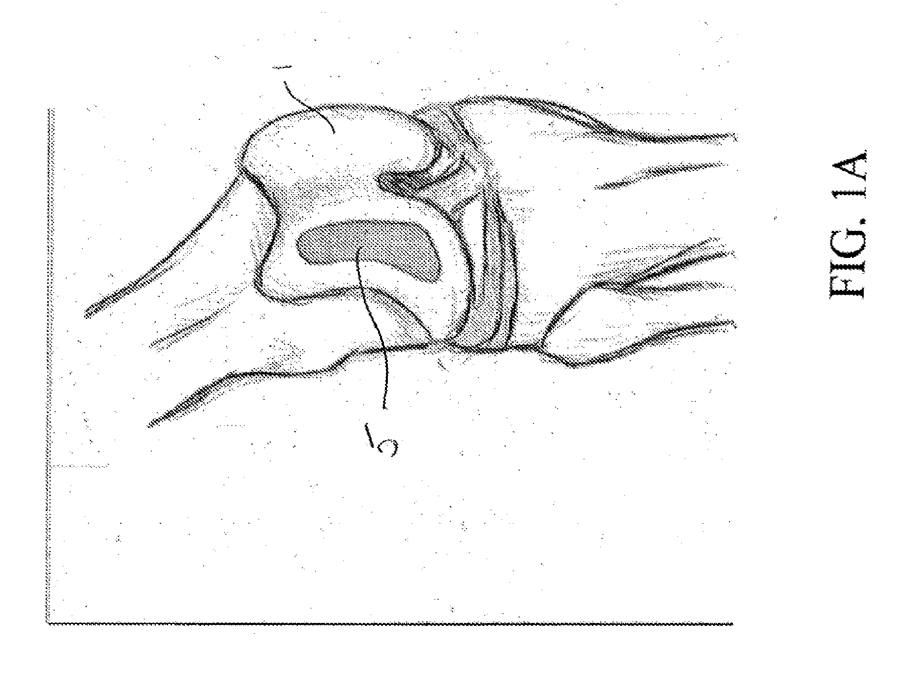 System and method for three dimensional printed implantation guides